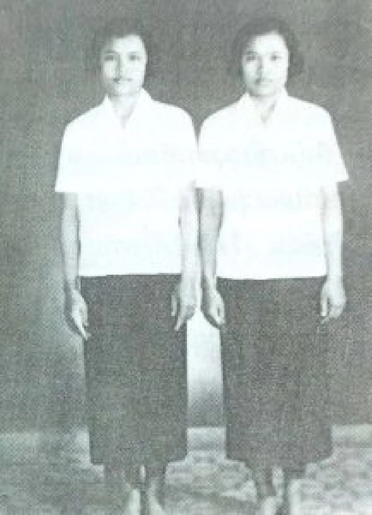 ฝาแฝด