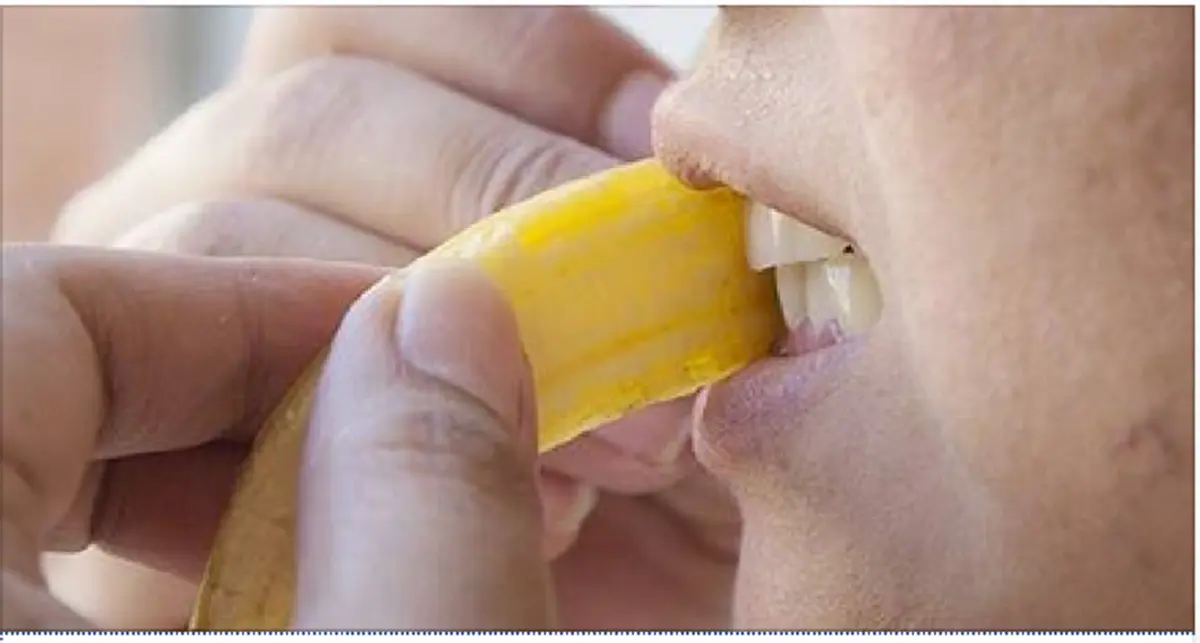 วิธีแก้ฟันเหลืองด้วยของดีใกล้ตัวจากธรรมชาติ