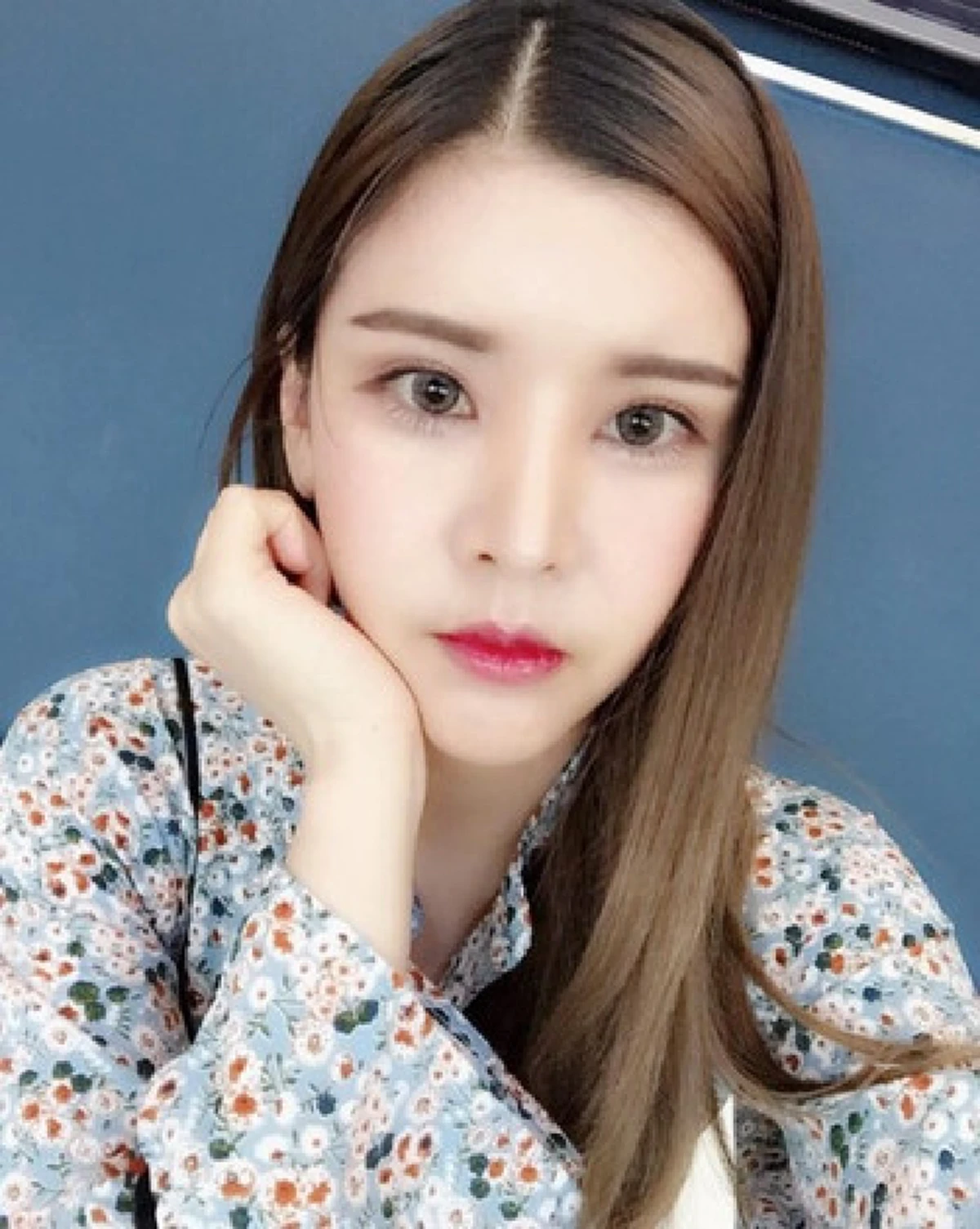 ตาลุกวาวทั้งประเทศ !! สาวไทยใจกล้าทุ่มเงินกว่า 6 ล้านบาท เพื่อเปลี่ยนชีวิต บอกเลยผลลัพธ์ที่ได้คุ้มมาก !? (ภาพ)