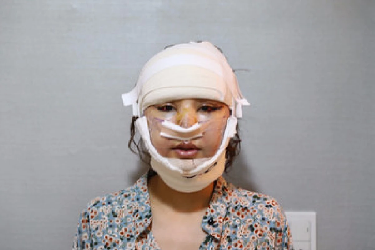 ตาลุกวาวทั้งประเทศ !! สาวไทยใจกล้าทุ่มเงินกว่า 6 ล้านบาท เพื่อเปลี่ยนชีวิต บอกเลยผลลัพธ์ที่ได้คุ้มมาก !? (ภาพ)