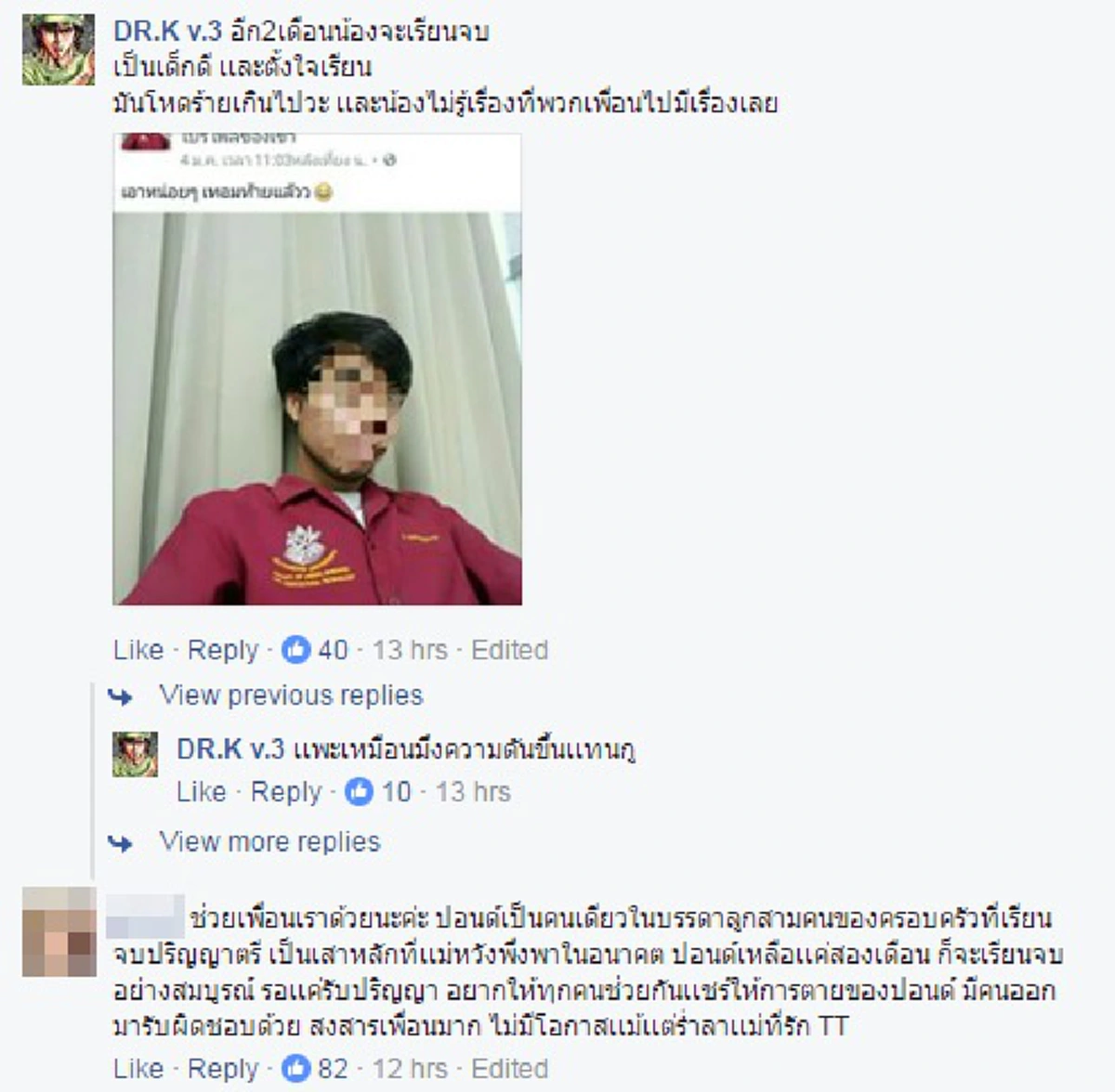 บอกเลยด่าพวกขี้เรื้อนยังน้อยไป!! เพจดังเปิดภาพ X-Ray กะโหลกน้องปอนด์ ว่าที่บัณฑิตม.ศิลปากร ถูกแก๊งทมิฬเมืองเพชรฯแทงหัวย้ำชัดๆ มันโคตรโหด??