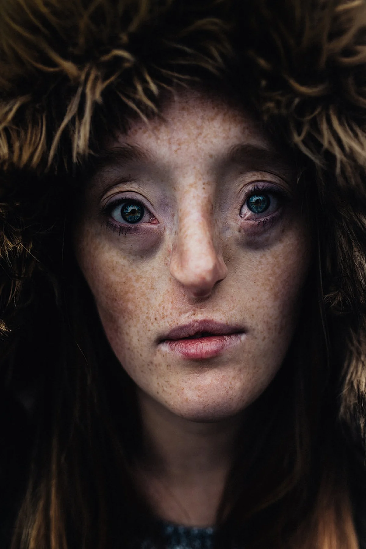 *ขยี้ตารัวๆ!!! เปิดภาพหญิงสาวหน้าแปลก ถูกตราหน้าว่าไม่สวย แต่ทุกวันนี้เธอคือนางแบบมืออาชีพที่ดังไปทั่วโลก!!! (คลิป)