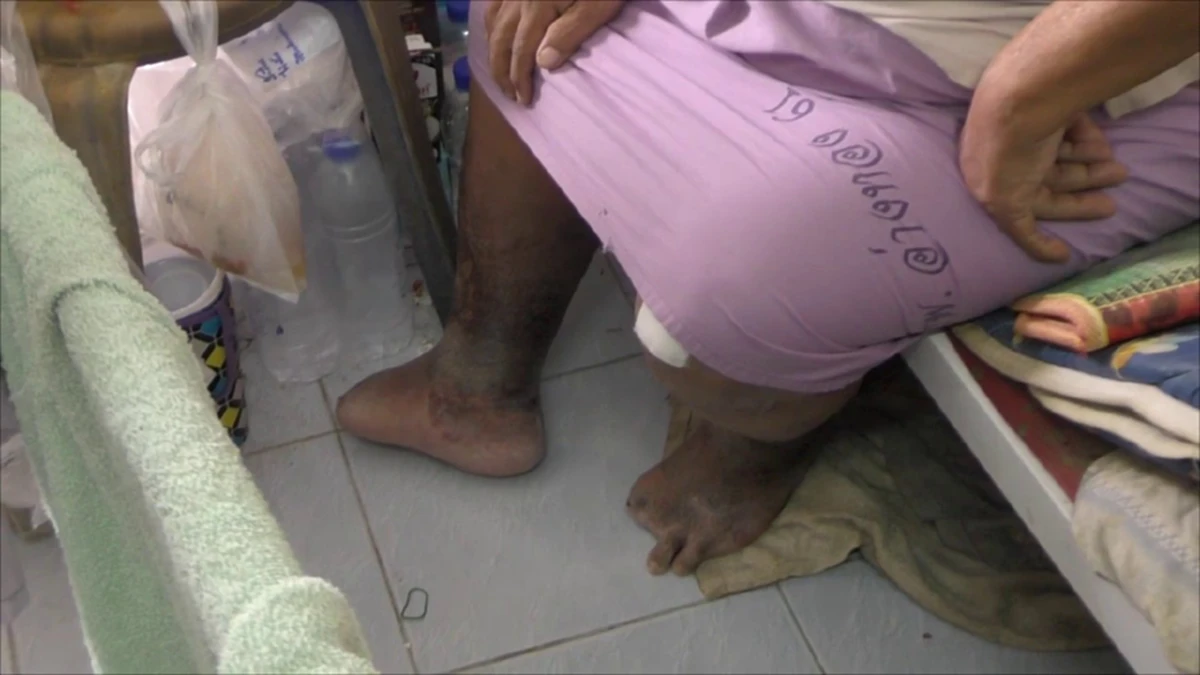 วอนช่วยเหลืออดีตดีเจดังวัย58 ป่วยเบาหวานกลายเป็นผู้พิการ ต้องอาศัยอยู่ในห้องเช่าเพียงลำพัง