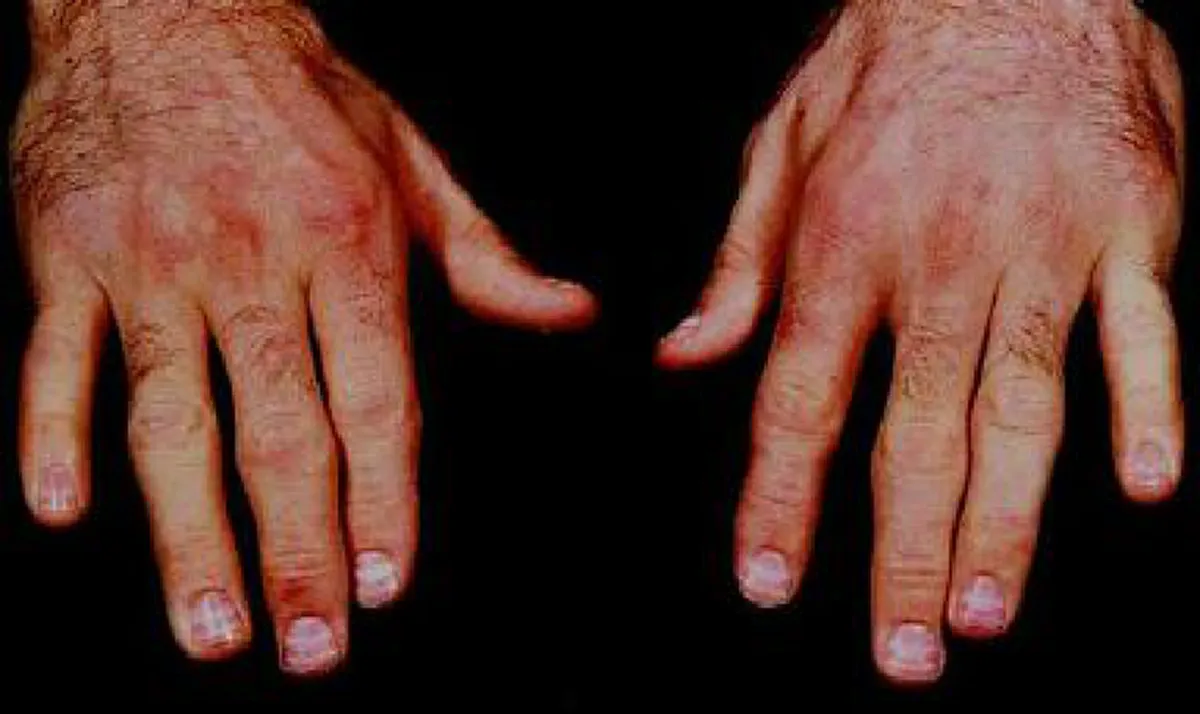 แพทย์ ชี้ น้ำมนต์ศักดิ์สิทธิ์อาจารย์ดัง เสี่ยงติดเชื้อ อันตรายถึงชีวิตได้