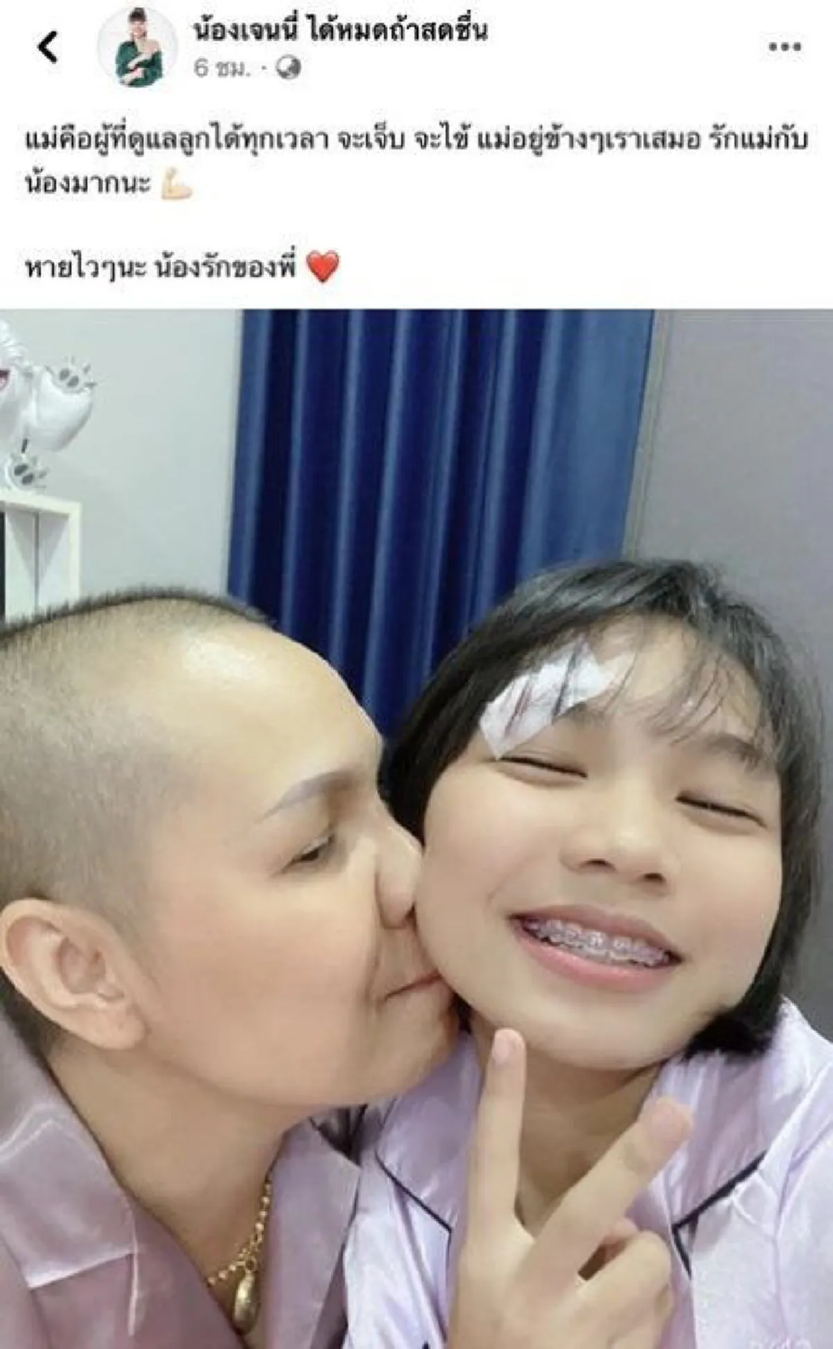 ชาวเน็ตผิดสังเกต น้องลิลลี่ หัวฟาดพื้น