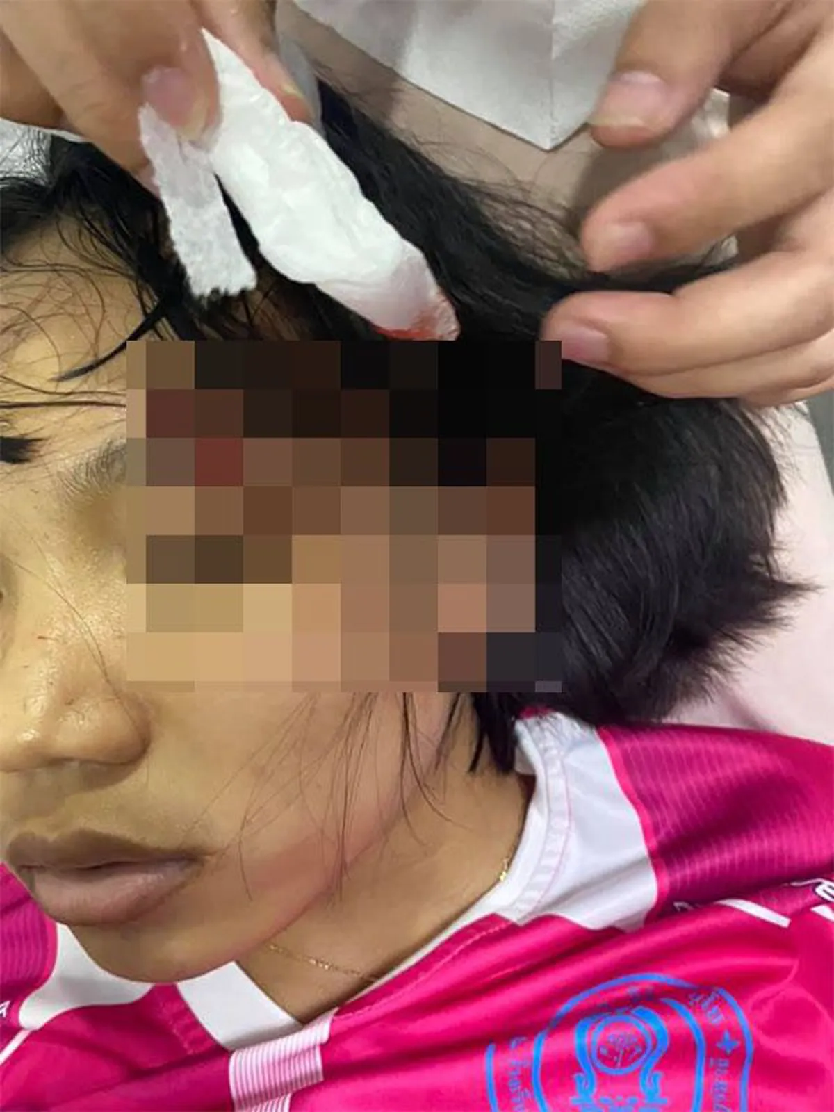 ชาวเน็ตผิดสังเกต น้องลิลลี่ หัวฟาดพื้น