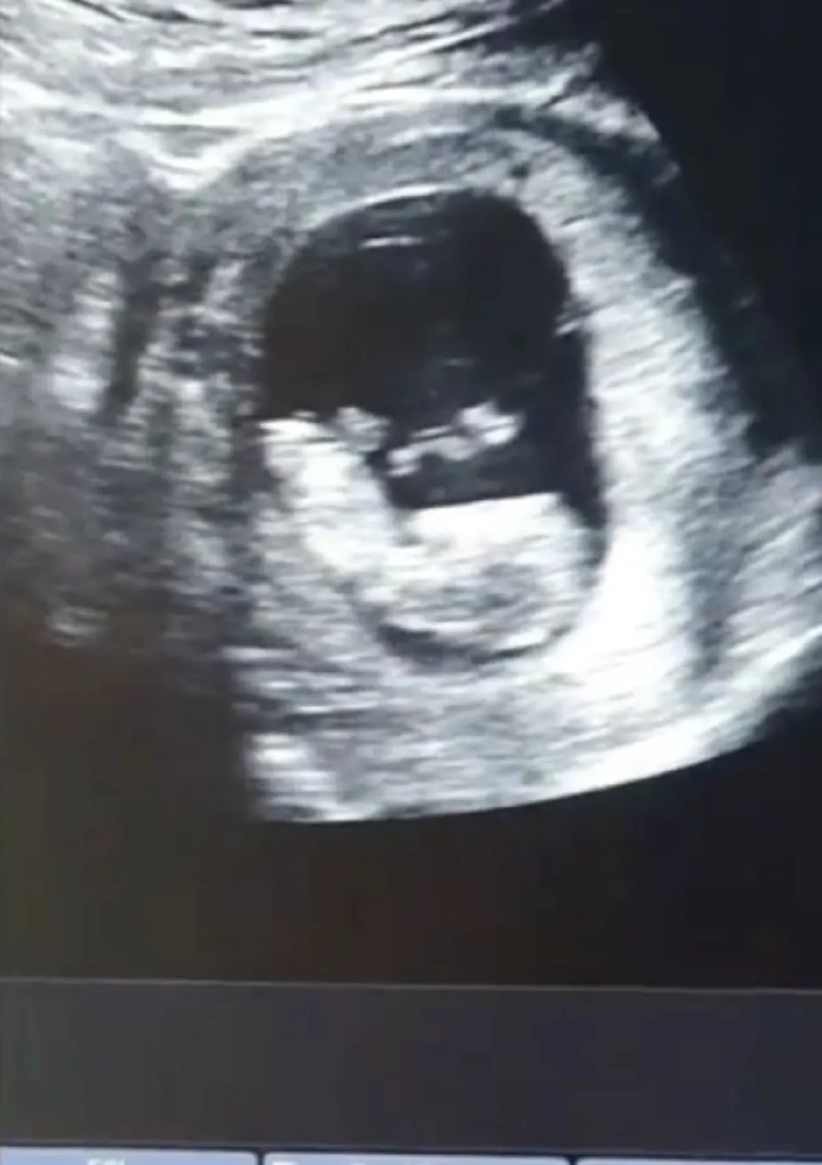 นาตาลี เดวิส ประกาศข่าวดีท้องแล้ว หลังเคยเศร้า สูญเสียลูกคนแรก