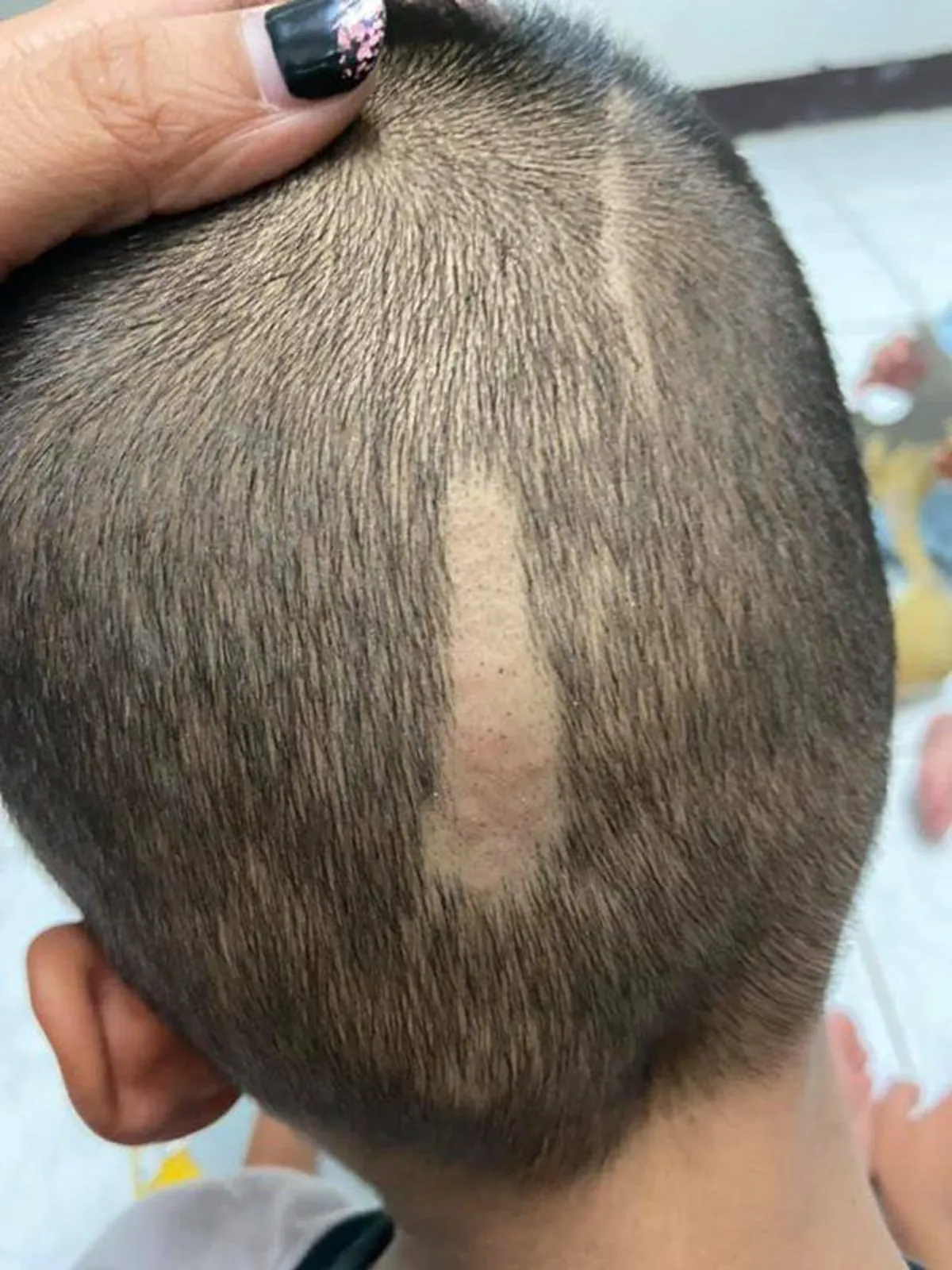 แม่ยอมไม่ได้ ลูกชายวัย 7 ขวบ โดนรุ่นพี่แกล้งกล้อนผม ซัดแหลกครูรร.ดังชลบุรีบอกเอาผิดไม่ได้