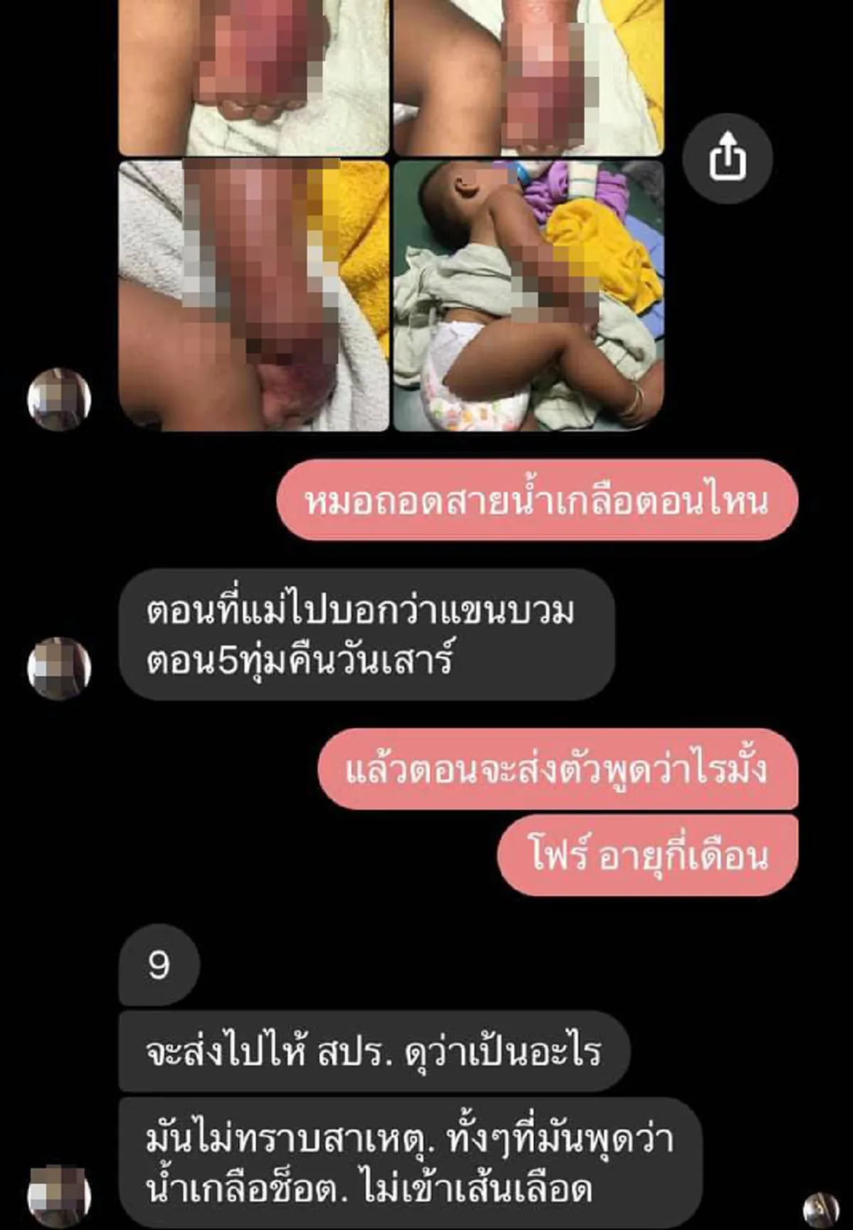 ญาติแฉยับ หลานวัย 9 เดือนเข้ารพ.ให้น้ำเกลือจู่ๆมือบวมไหม้เรียกพยาบาลมาดูโบ้ยเป็นความผิดคนเฝ้า