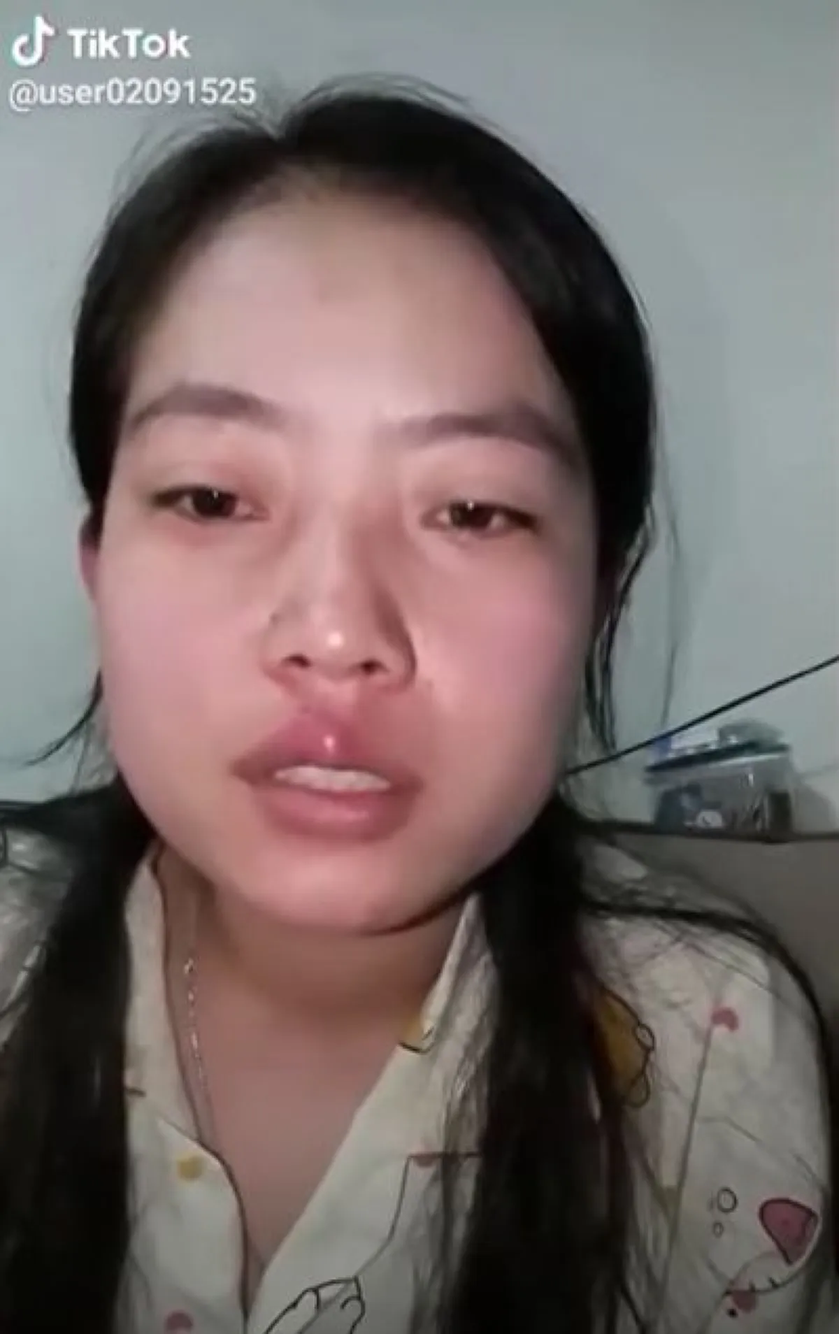 หมอแล็บแพนด้า ออกเตือน อย่าหาทำ ให้ผึ้งต่อยหวังปากกระจับ พลาดอาจถึงตาย