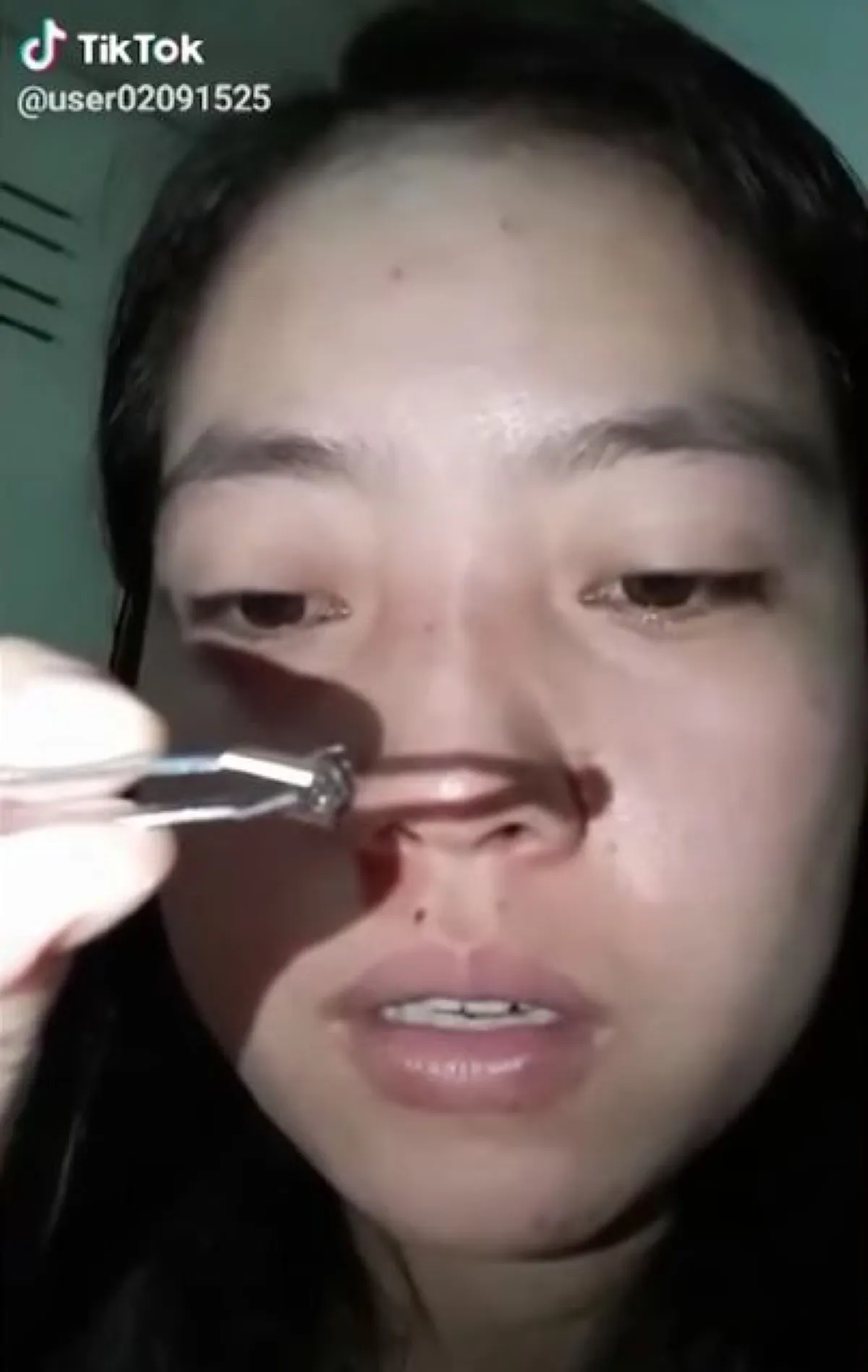 หมอแล็บแพนด้า ออกเตือน อย่าหาทำ ให้ผึ้งต่อยหวังปากกระจับ พลาดอาจถึงตาย