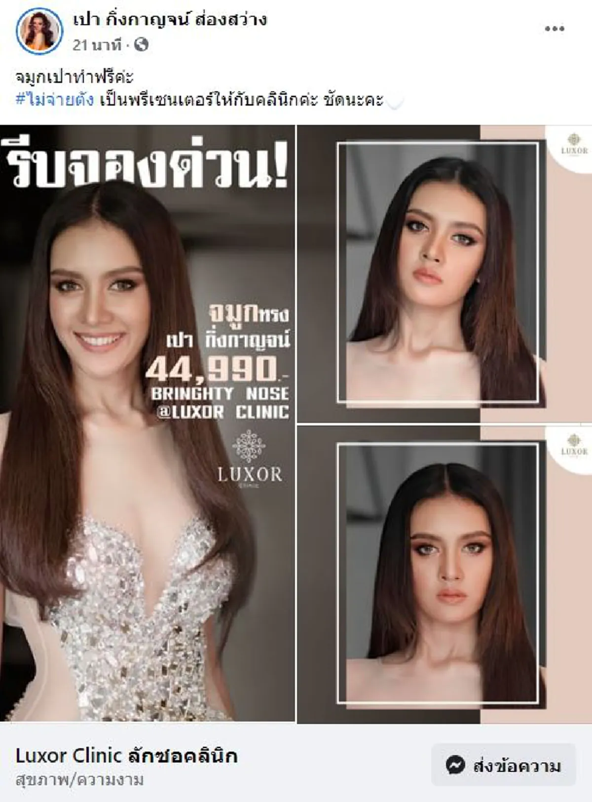 เปา กิ่งกาญจน์ ตอกกลับชาวเน็ตไม่ไว้หน้า หลังทำจมูกจนปัง ทั้งที่ไม่มีเงินใช้