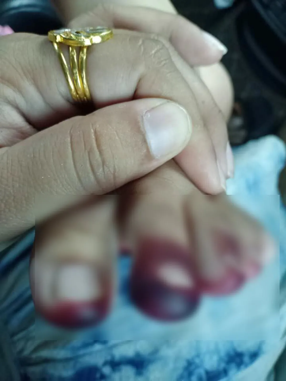 แพทย์เตือน กิ้งกือ บางสายพันธุ์มีพิษร้าย สามารถพ่นออกไปได้ไกล แค่สัตว์เลื้อยคลานตัวเล็กๆก็มองข้ามไม่ได้