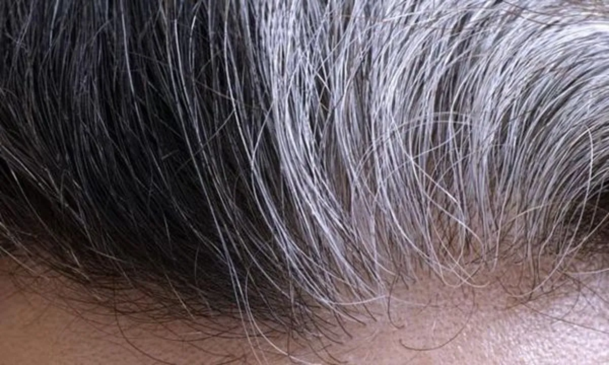 4 สาเหตุทำผมหงอกก่อนวัย รีบเลี่ยงให้ไวก่อนสายเกินแก้