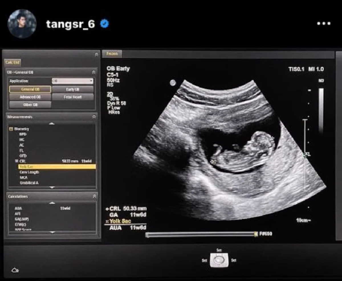 ภรรยา สารัช อยู่เย็น ให้กำเนิดลูกชาย ตั้งชื่อว่า ตุลย์