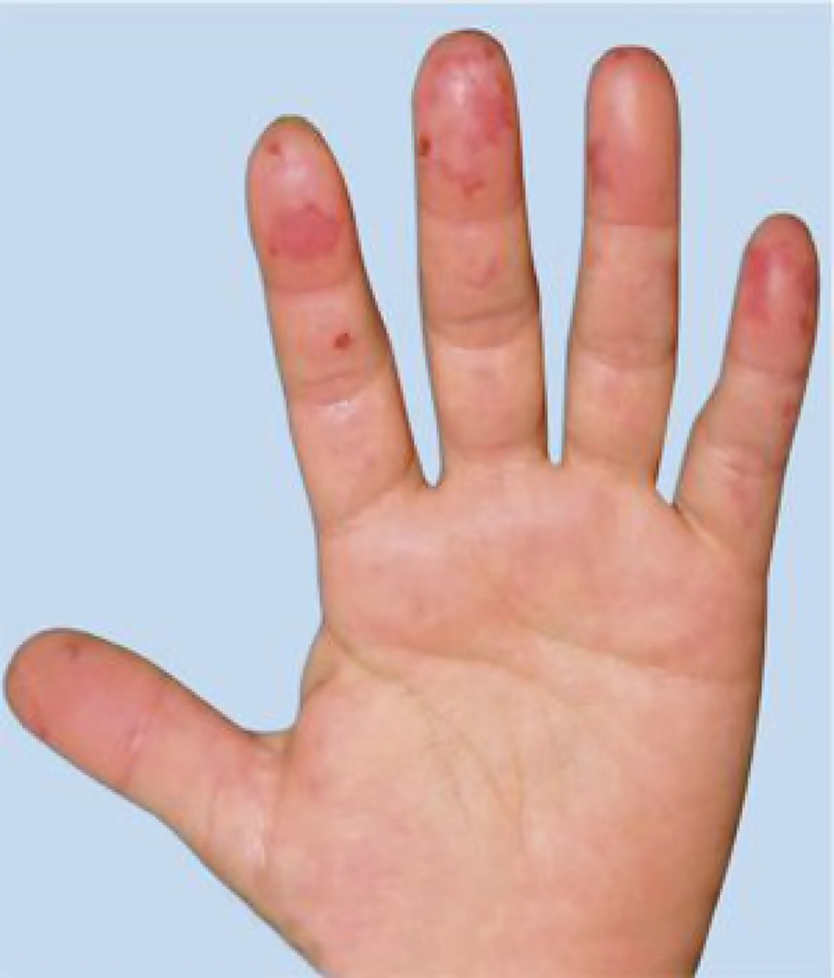 แพทย์เผย ผู้ป่วย13โรค ที่ห้ามนวดเด็ดขาด