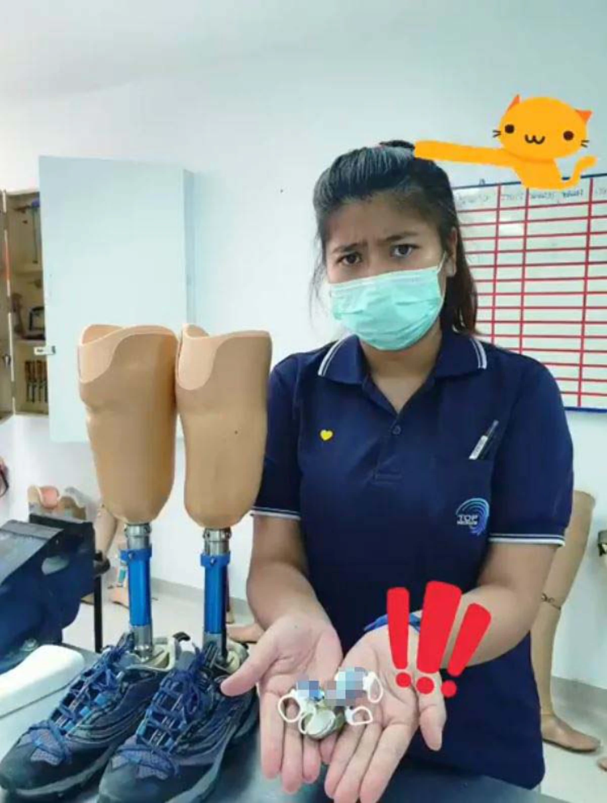 นักกายอุปกรณ์ตีแผ่ความจริงหลายคนยังไม่รู้ สมัยนี้เลิกใช้ฝาอลูมิเนียมทำขาเทียมแล้ว