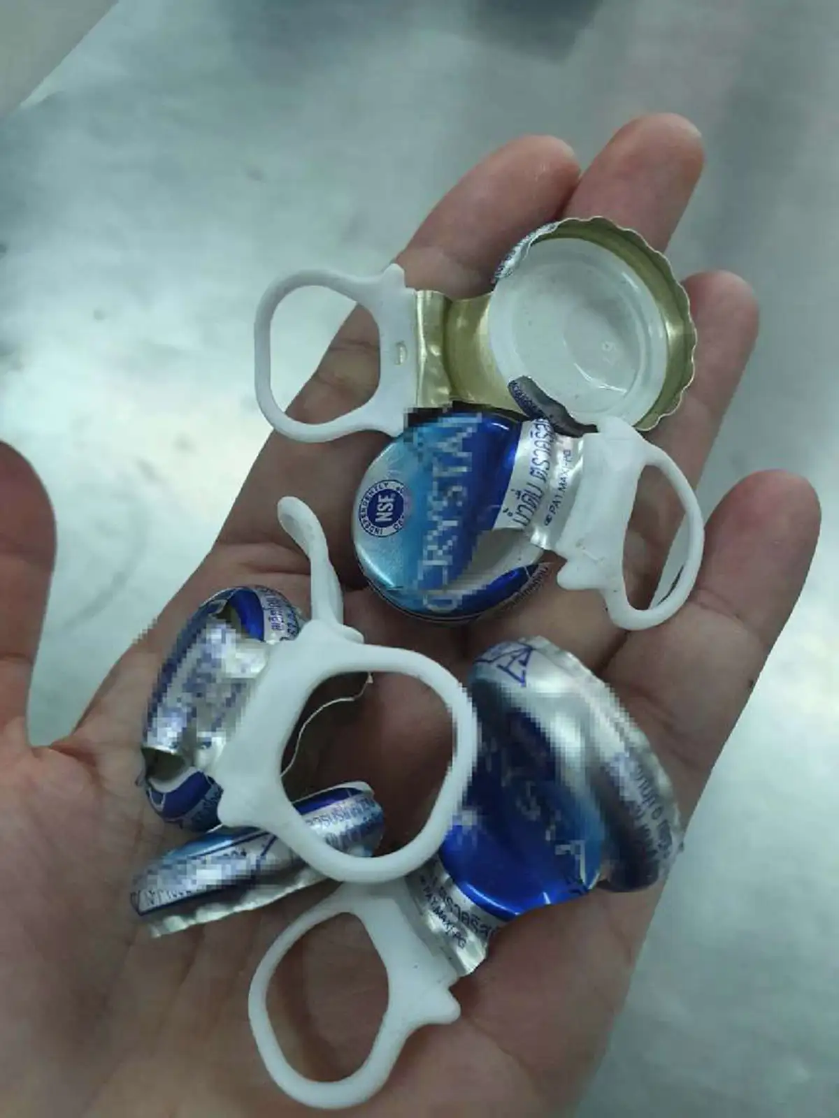 นักกายอุปกรณ์ตีแผ่ความจริงหลายคนยังไม่รู้ สมัยนี้เลิกใช้ฝาอลูมิเนียมทำขาเทียมแล้ว