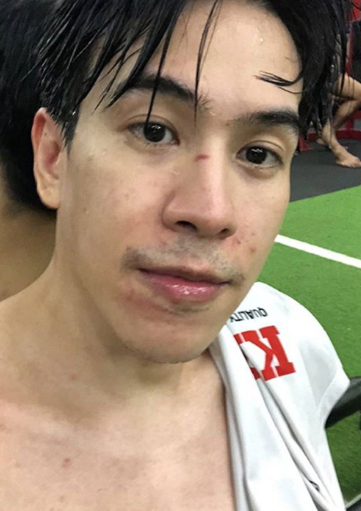 แฟนสาว บอล อัศนัย เผยภาพเบื้องหลังความทุกข์ทรมานก่อนขึ้นชก ทีแฟนหนุ่มต้องทนเจ็บตาเขียวตัวช้ำปากแตก
