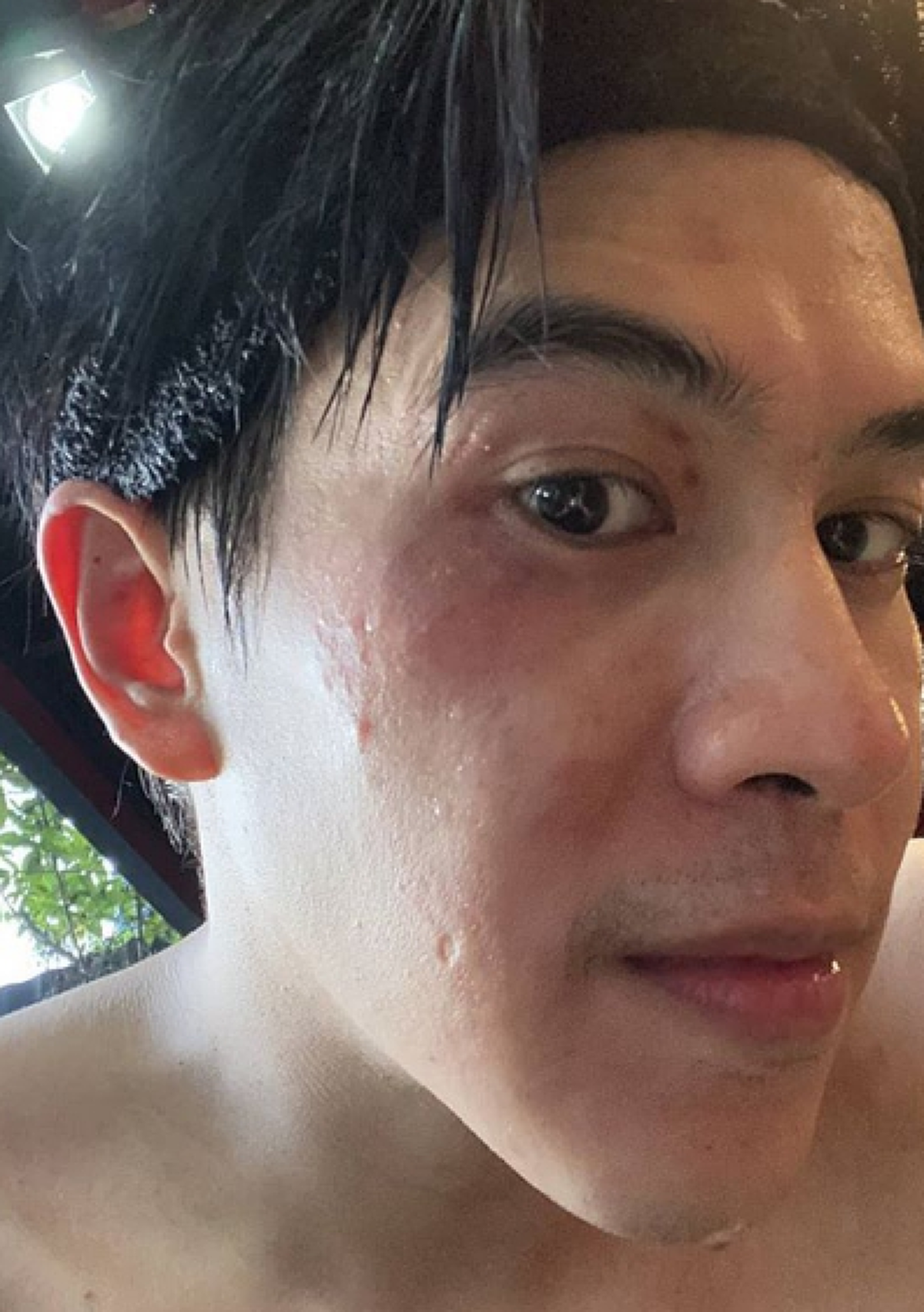 แฟนสาว บอล อัศนัย เผยภาพเบื้องหลังความทุกข์ทรมานก่อนขึ้นชก ทีแฟนหนุ่มต้องทนเจ็บตาเขียวตัวช้ำปากแตก