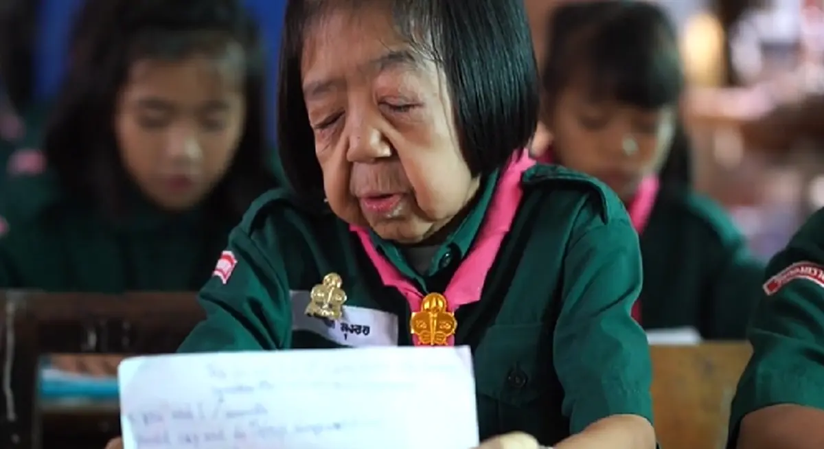 เปิดชีวิต น้องเจนนี่ หนูน้อยวัย 11 ปี ป่วยโรคชราในเด็ก แต่กำลังใจเหลือล้นมีแม่อยู่ข้างๆ