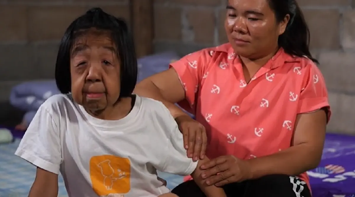 เปิดชีวิต น้องเจนนี่ หนูน้อยวัย 11 ปี ป่วยโรคชราในเด็ก แต่กำลังใจเหลือล้นมีแม่อยู่ข้างๆ