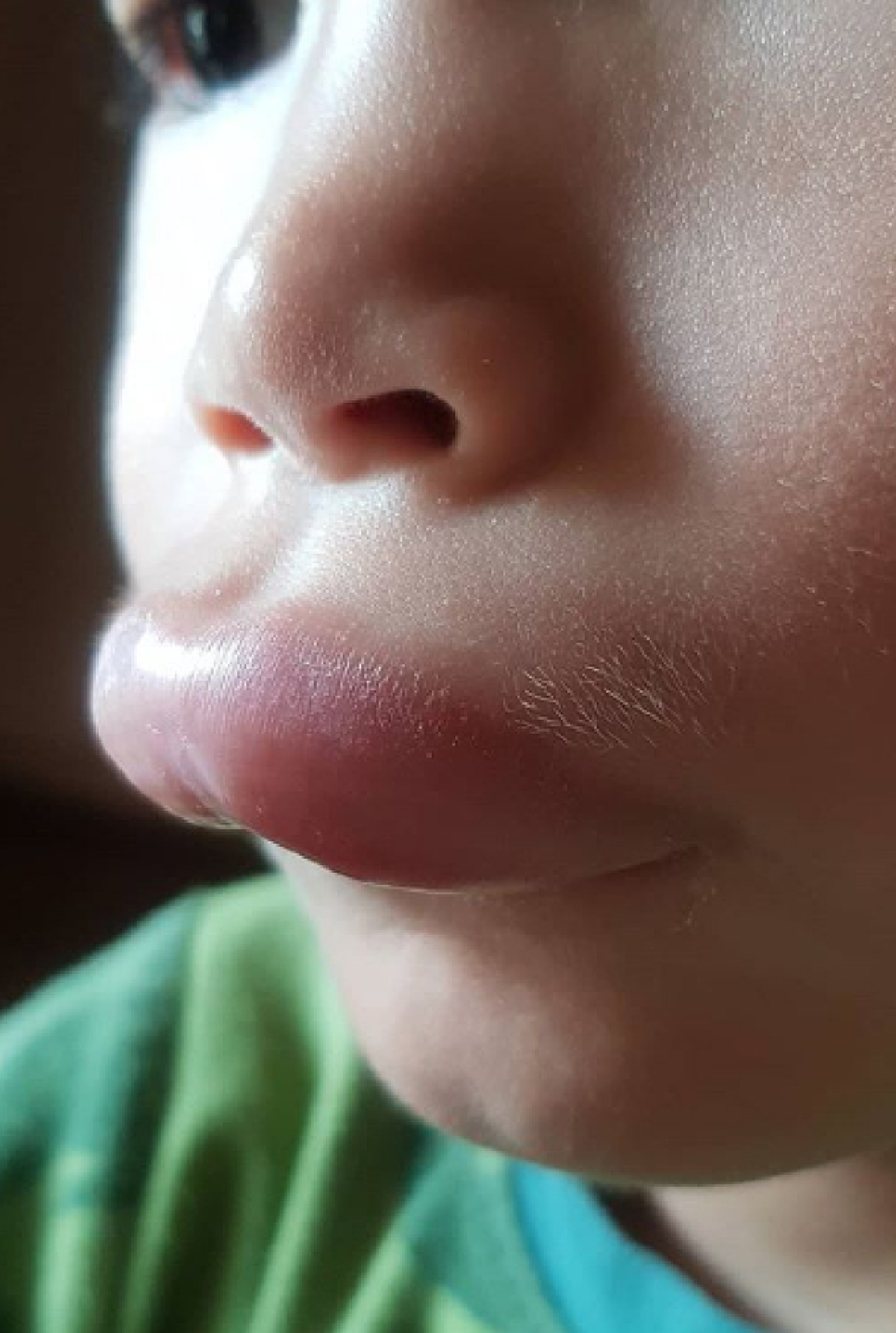 พลอย อดีตภรรยา ปีเตอร์ คอร์ป เผยภาพลูกชายน้องพูม่า ปากบวมฉึ่ง ก่อนเฉลยใครเป็นคนทำ