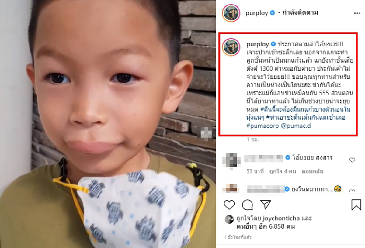 พลอย อดีตภรรยา ปีเตอร์ คอร์ป เผยภาพลูกชายน้องพูม่า ปากบวมฉึ่ง ก่อนเฉลยใครเป็นคนทำ