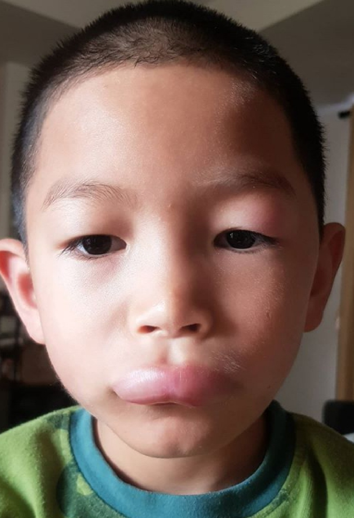 พลอย อดีตภรรยา ปีเตอร์ คอร์ป เผยภาพลูกชายน้องพูม่า ปากบวมฉึ่ง ก่อนเฉลยใครเป็นคนทำ