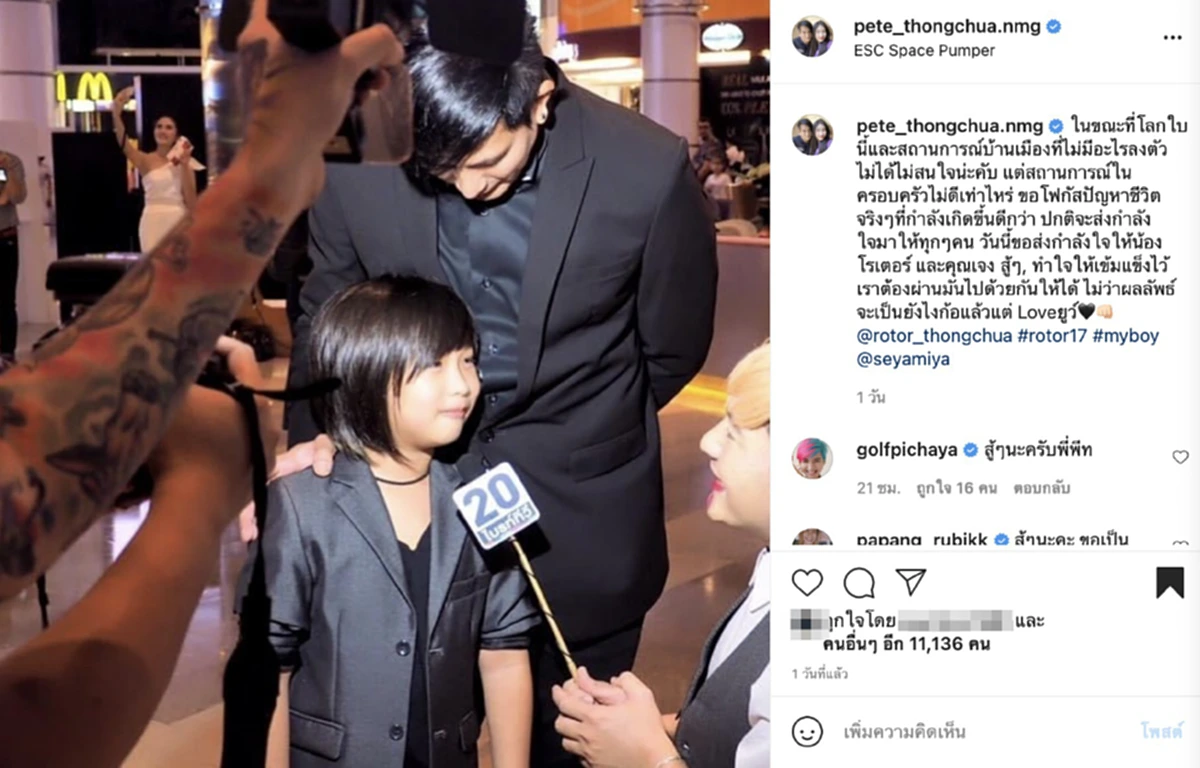 พีท ทองเจือ น้องโรเตอร์ ผ่าตัดสะโพก ล้มสเก็ตบอร์ด