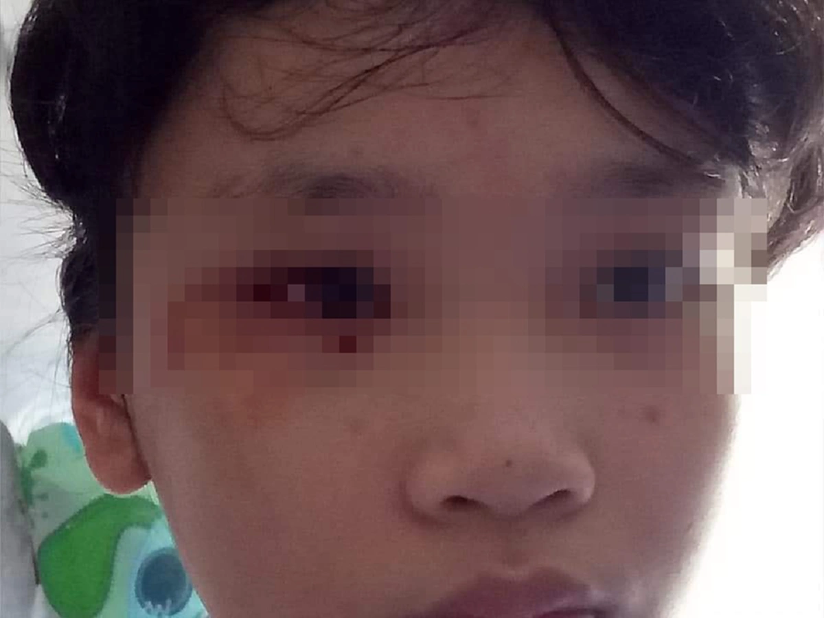 แม่โพสต์เล่าอุทาหรณ์ หลังลูกสาวจ้องมือถือนาน