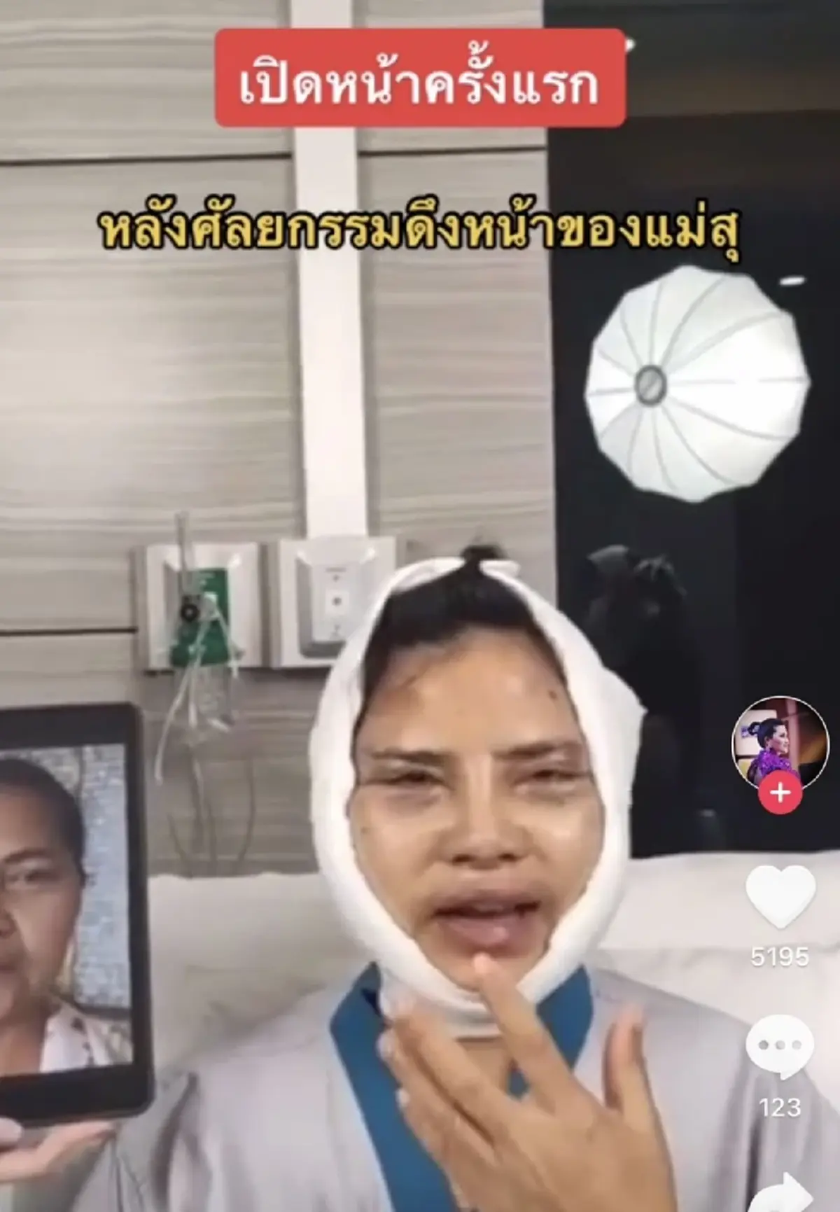 สุนารี  ราชสีมา ศัลยกรรม ทำหน้า หน้าใหม่ เปิดภาพล่าสุด