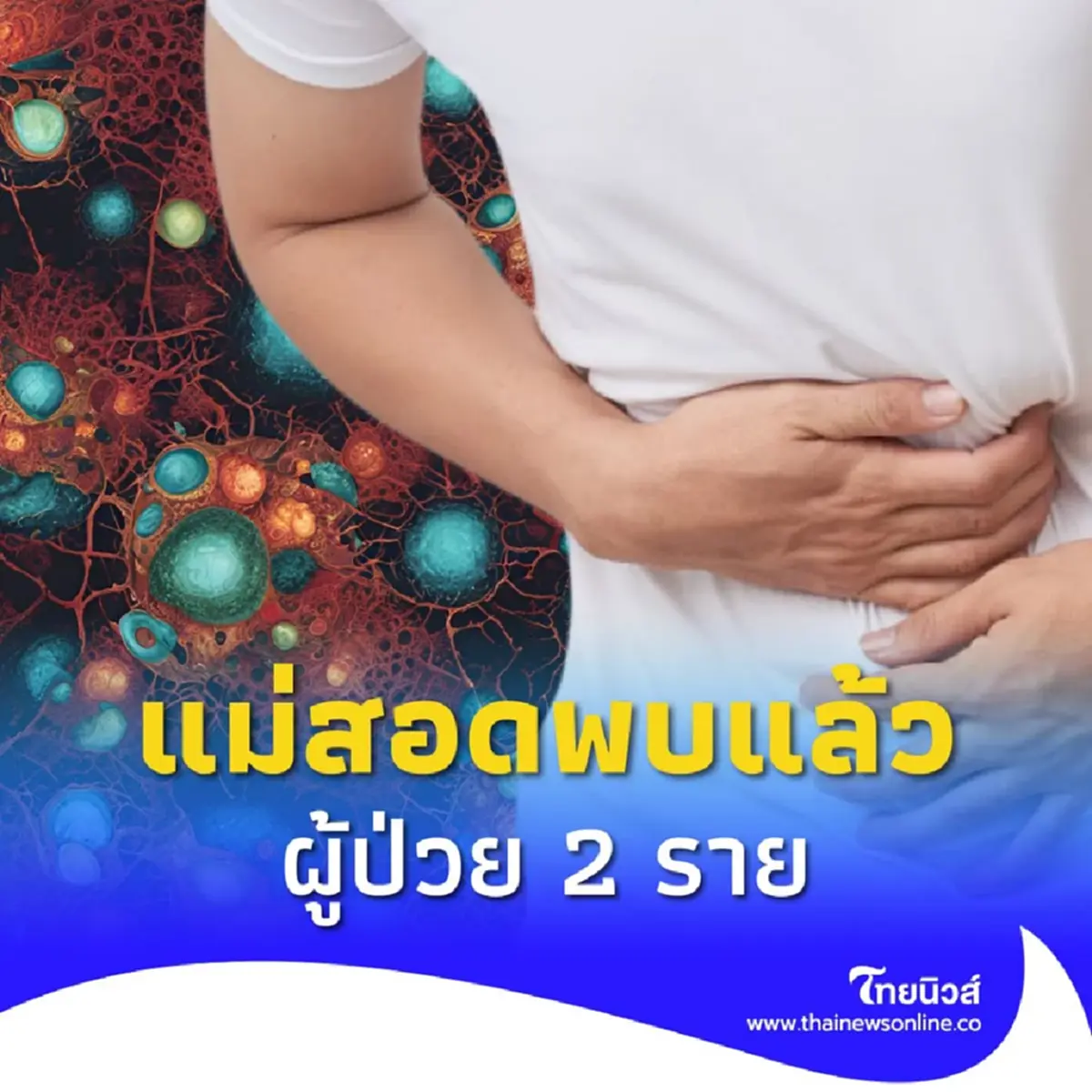 แม่สอดพบแล้ว อหิวาตกโรค 2 ราย ส่งกำลังสกัดคุมชายแดนเข้ม