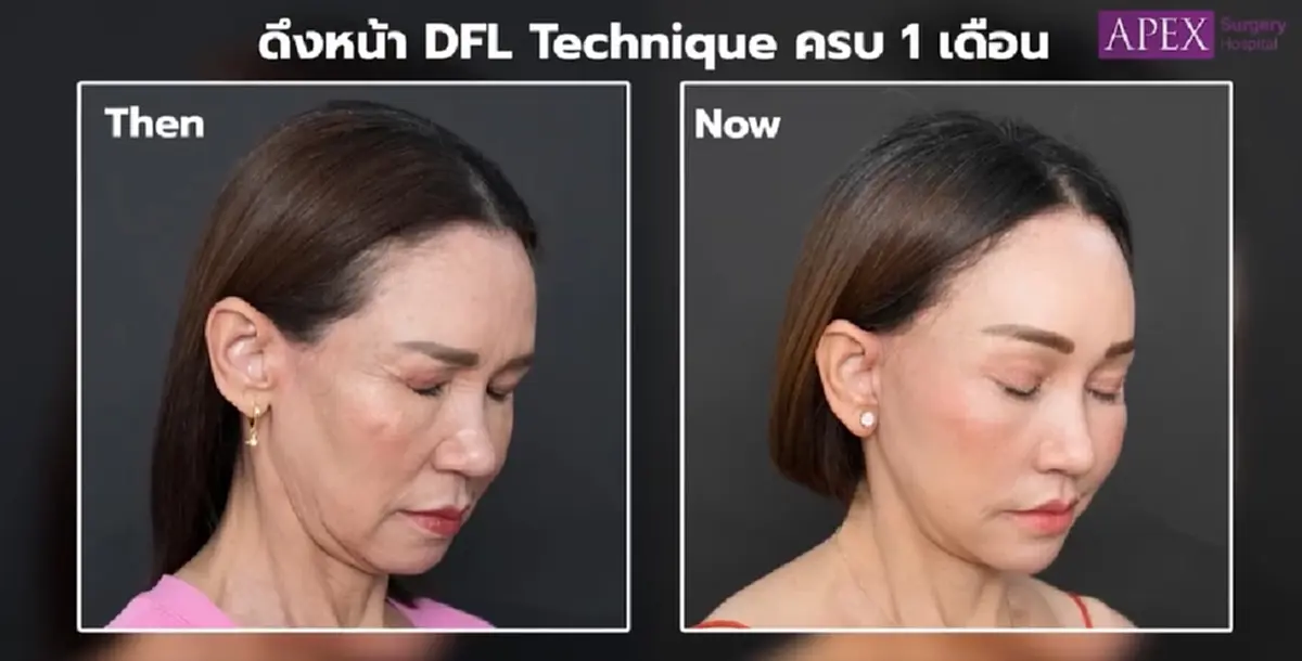 เปิดหน้าใหม่ นักแสดงรุ่นใหญ่ ฉลองวาเลนไทน์ในวัย 58 ปี สวยเป๊ะ จนจำแทบไม่ได้