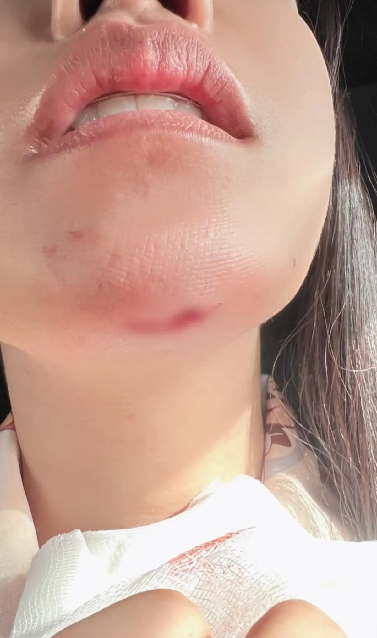 \"หมอโบว์\" วูบล้มเลือดอาบคาง น้ำหนักหาย 3โล หลังสูญเสียครั้งใหญ่