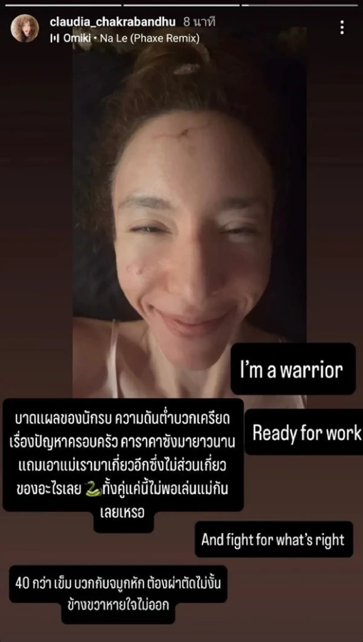 "คลาวเดีย" ยอมพูดแล้ว สาเหตุแท้จริง ล้มหัวฟาดพื้นเย็บกว่า 35 เข็ม