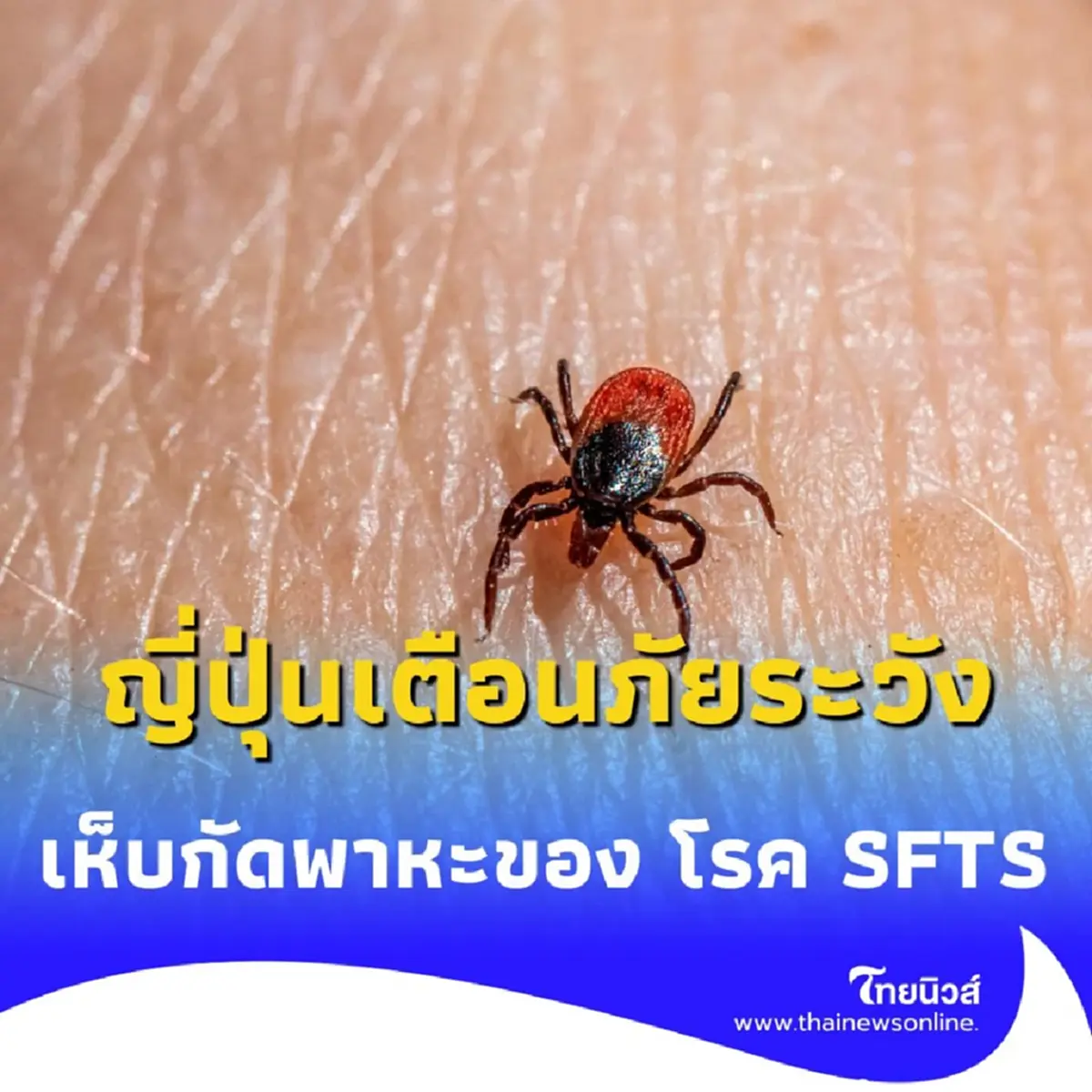 ระวังภัยใกล้ตัว พบผู้เสียชีวิต 2 ราย จากการถูกเห็บกัด ในญี่ปุ่น
