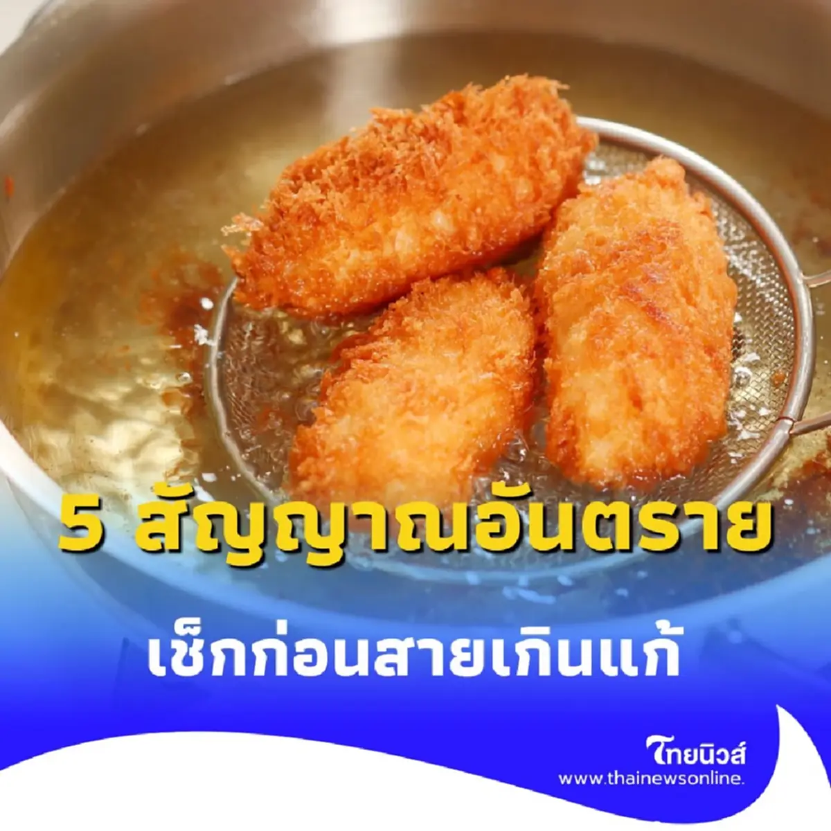 เตือนภัยเงียบ 5 อาการสัญญาณอันตราย นิ่วในถุงน้ำดี เช็กก่อนสายเกินแก้