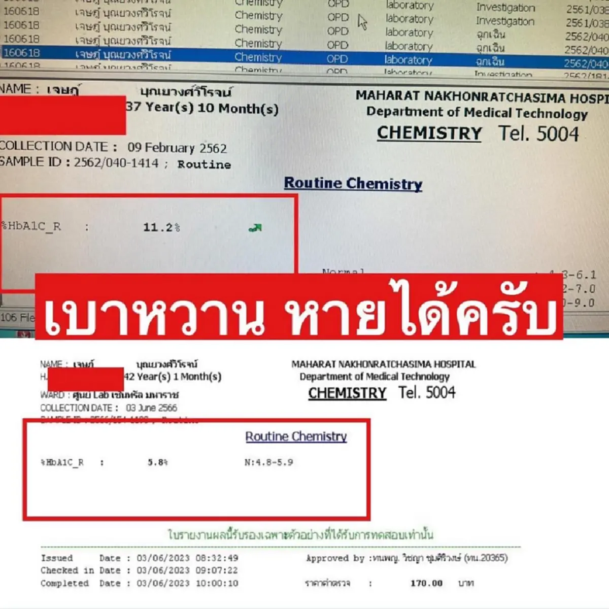เปิด 5วิธี ทำตามนี้ เบาหวาน หายแน่นอน แบบไม่ต้องพึ่งยา