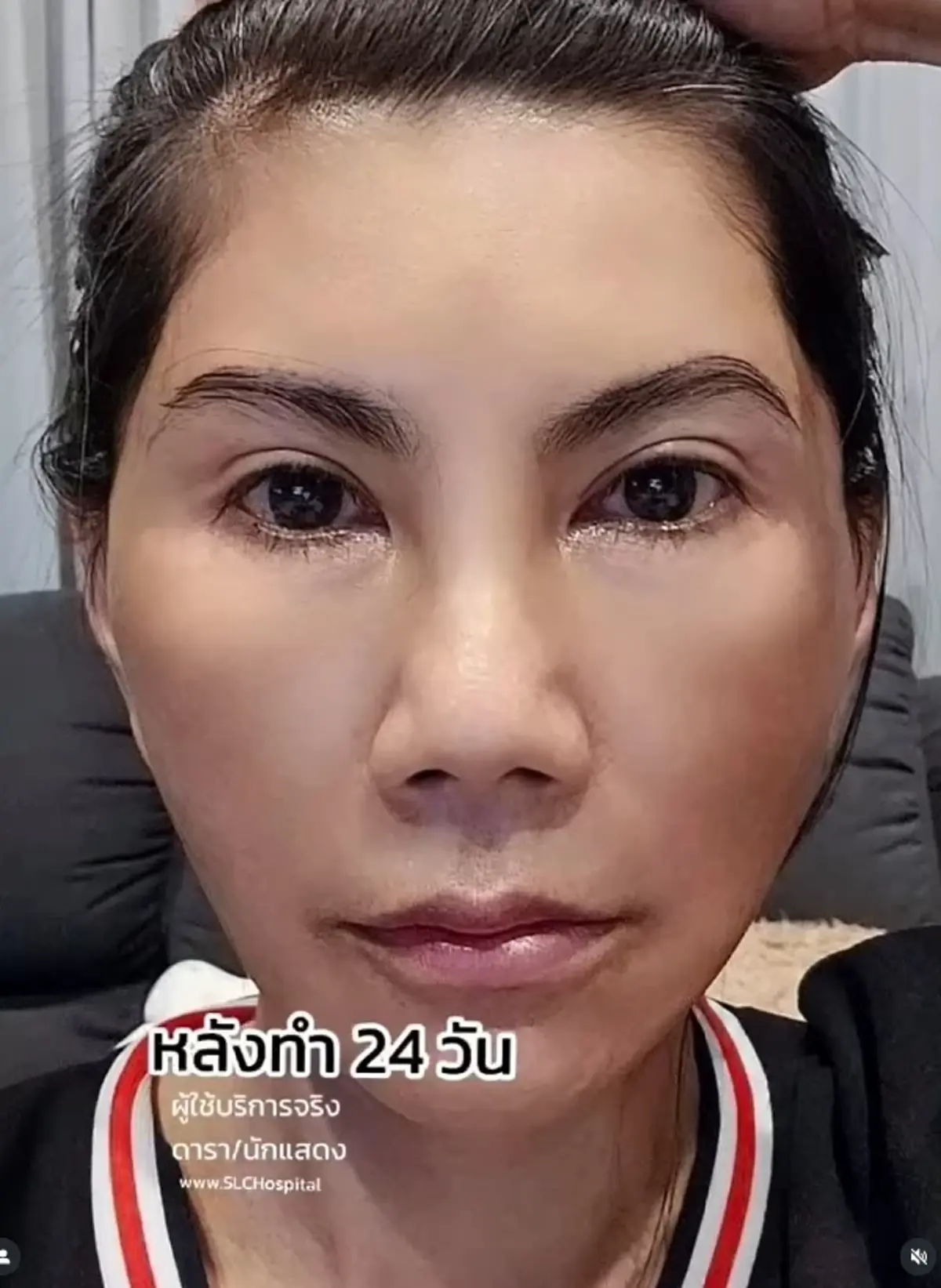 "แก้ว อภิรดี" เปิดหน้าใหม่หลังศัลฯ 2 เดือน ลืมไปเลยว่าใกล้แตะเลข 6