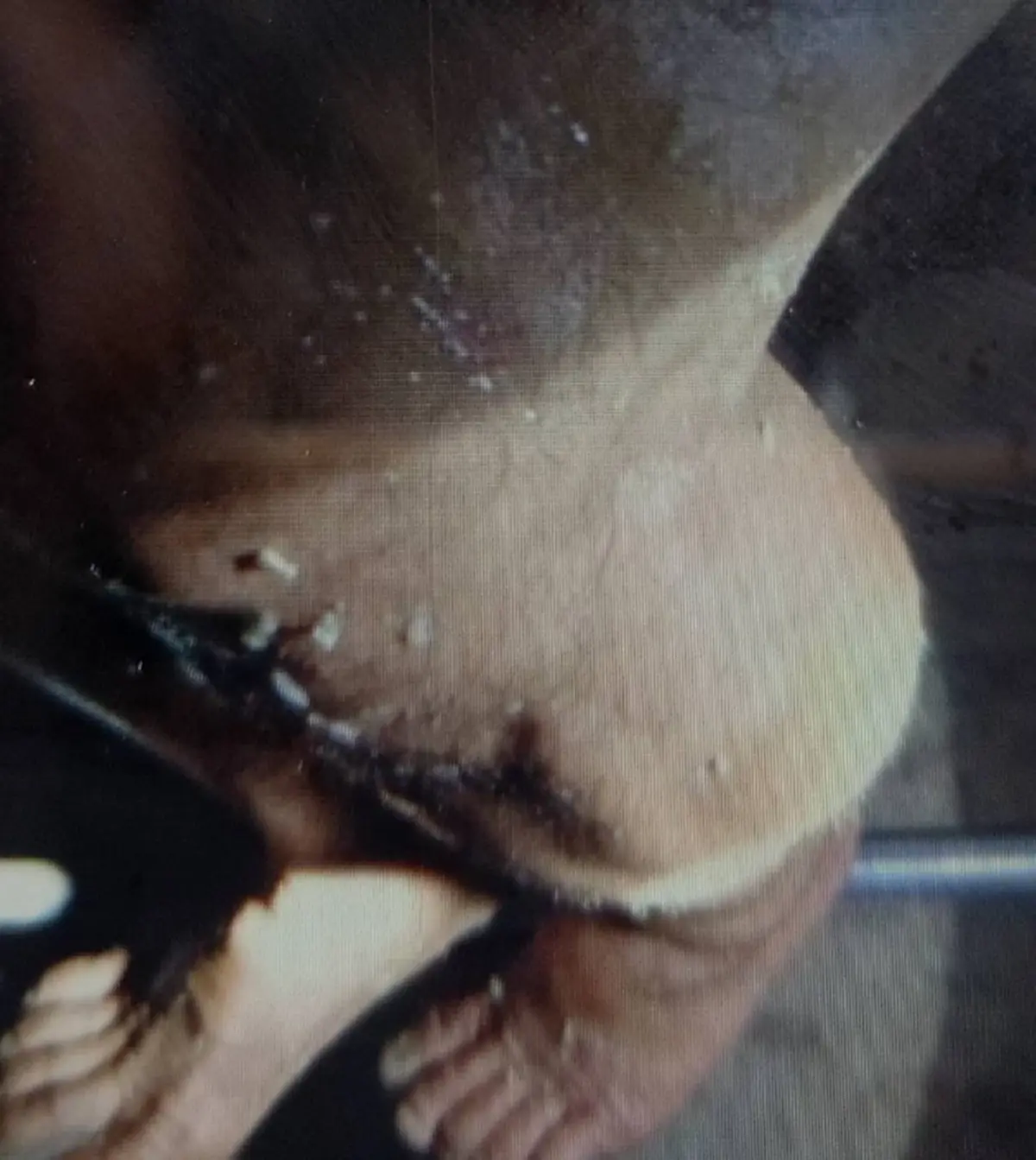 ลุงวัย 59 จู่ๆ มีหนอนไต่ออกมาตามตัว รู้ว่าไปทำอะไรมาน่าเห็นใจ