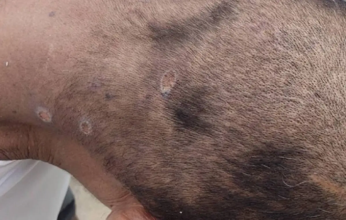 ลุงวัย 59 จู่ๆ มีหนอนไต่ออกมาตามตัว รู้ว่าไปทำอะไรมาน่าเห็นใจ