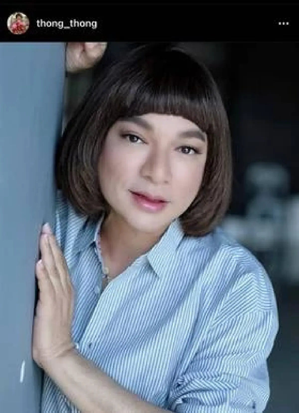 ตลกชื่อดังตกใจ - ขวัญเสีย ประสบอุบัติเหตุ คู่กรณีอายุ 19 อาการหนัก