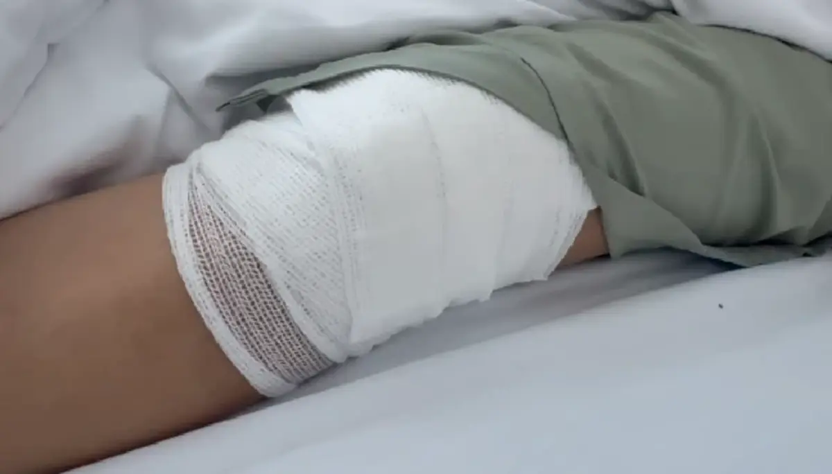 อาการล่าสุด นศ.สาว เหยื่อรถเมล์ย้อนศร ถูกชนกระโหลกร้าว