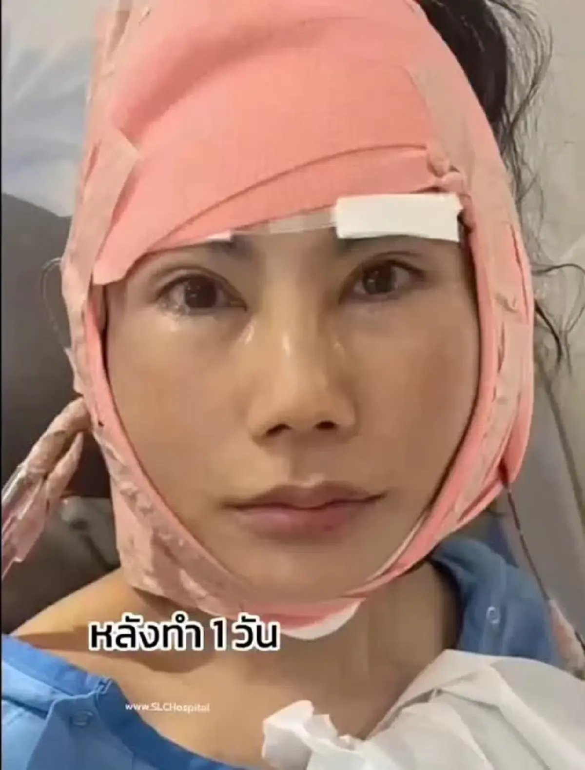 "แก้ว อภิรดี" เปิดหน้าใหม่หลังศัลฯ 2 เดือน ลืมไปเลยว่าใกล้แตะเลข 6