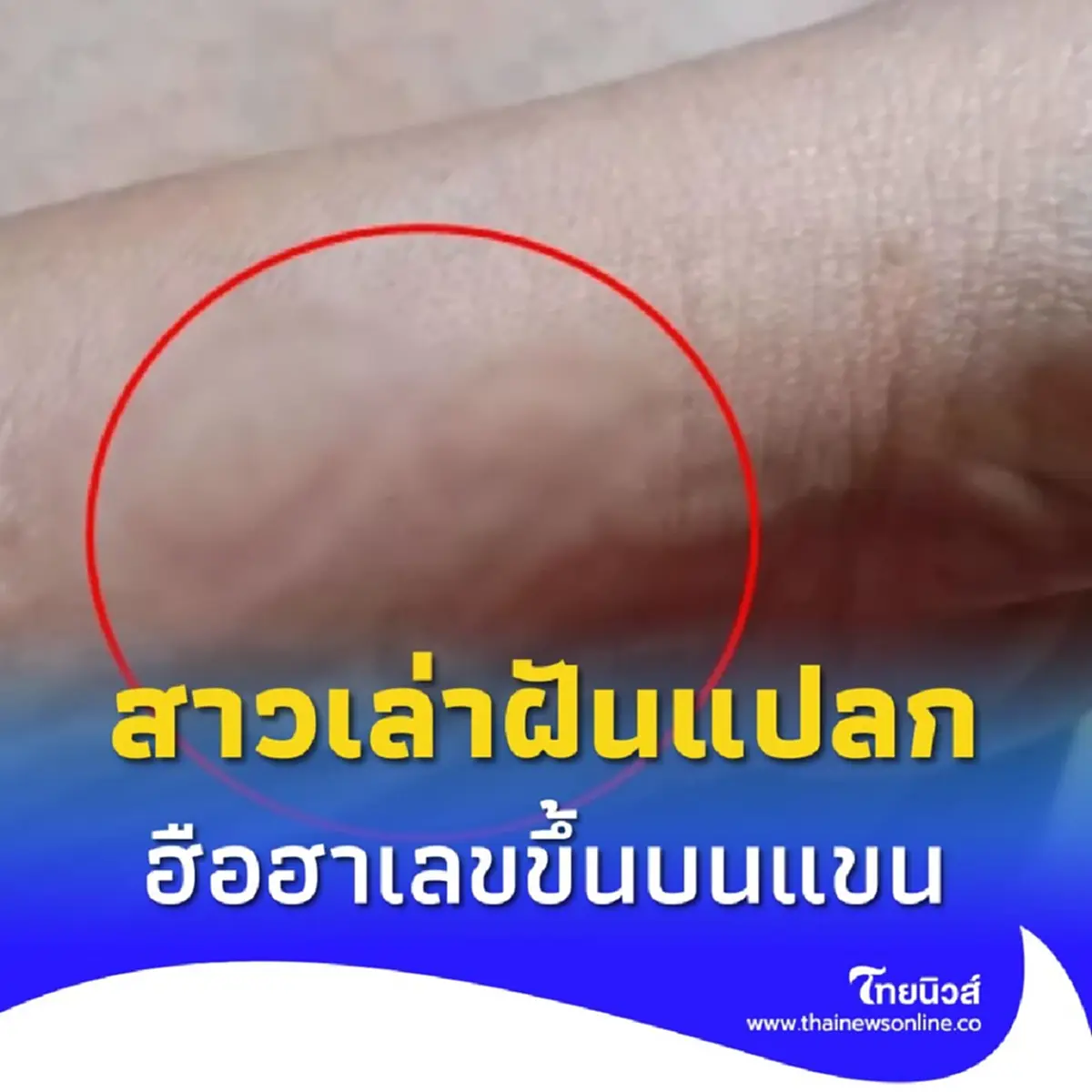 ฮือฮา เลขขึ้นบนแขน สาวฝันแปลกมีคนเอาแหวนทองมาสวมนิ้วให้