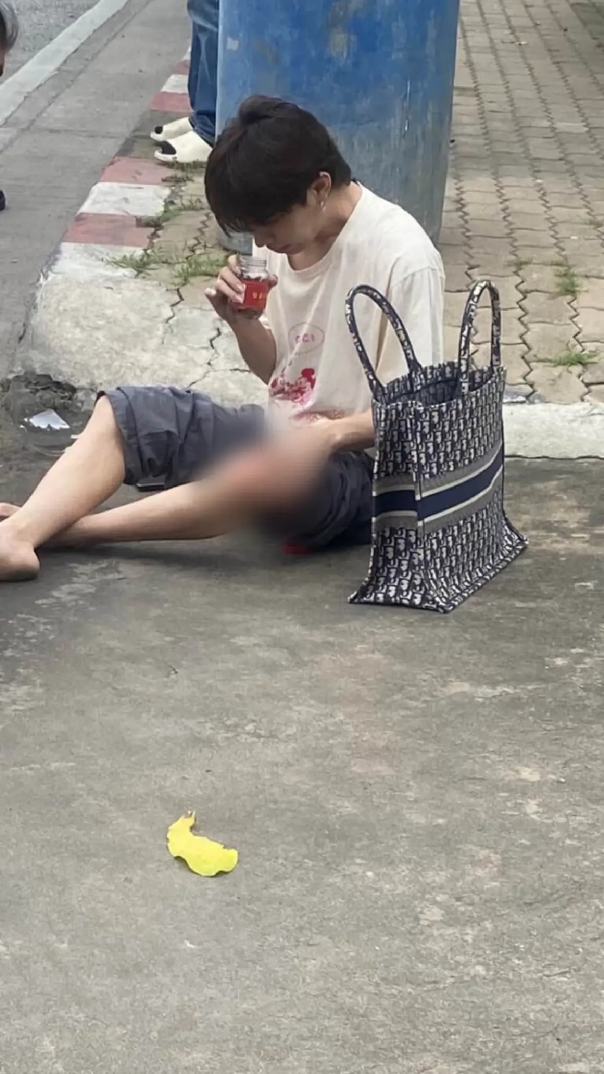 เอม ตามใจตุ๊ด เปิดภาพบาดแผลวันเกิดอุบัติเหตุ หน้าปู่ย่าลอยมาเลย