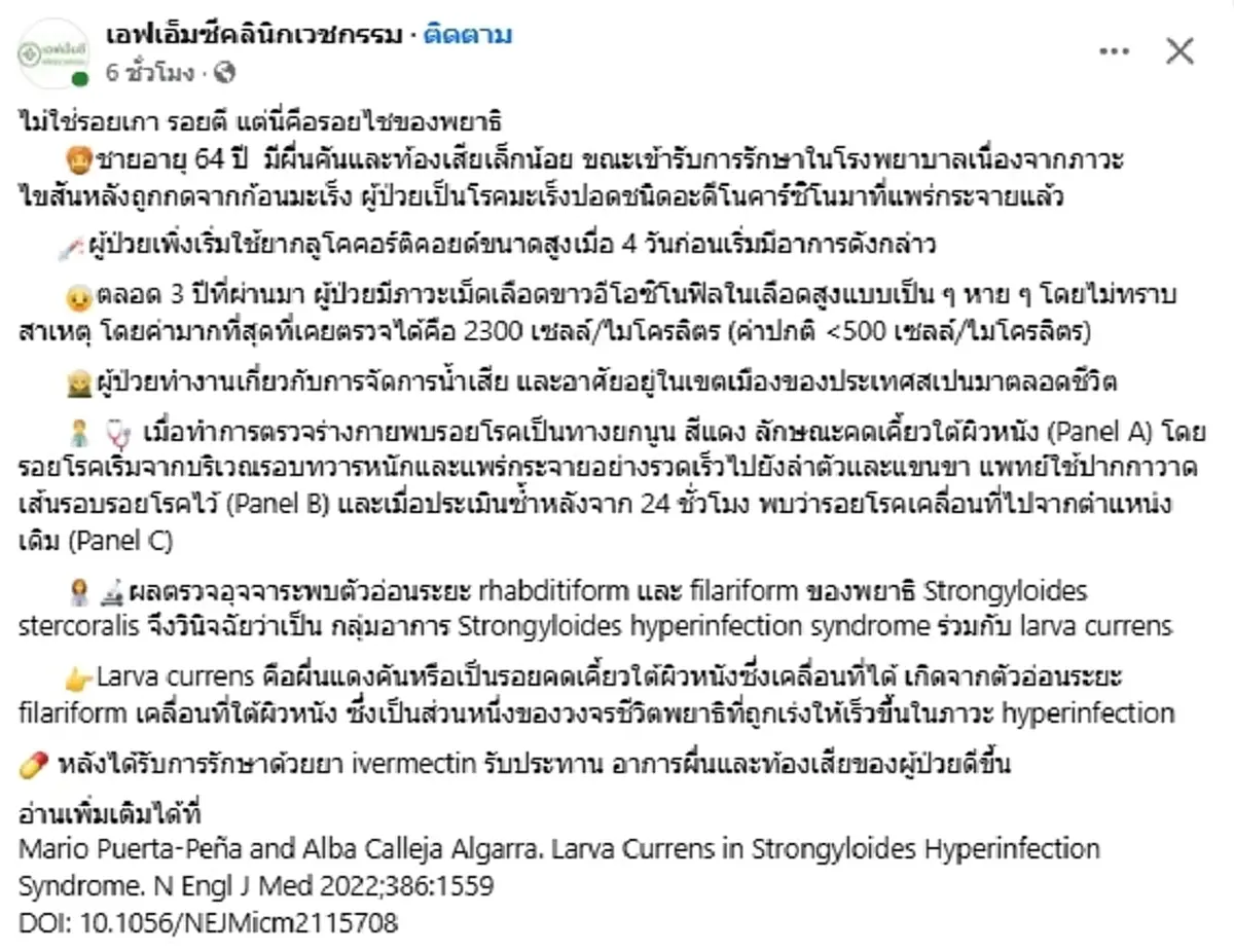 ขนลุก ชายวัย 64 ป่วยมะเร็ง มีผื่นแดงลามทั่วตัว รู้สาเหตุยิ่งตกใจ