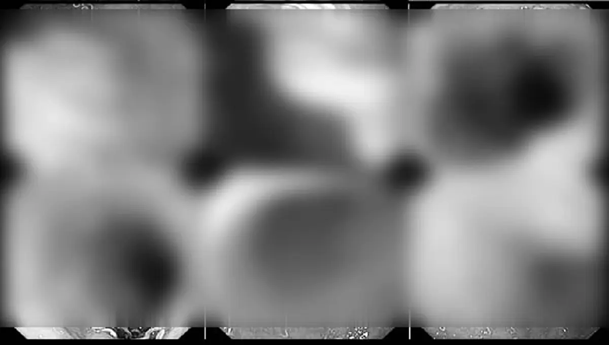 ตกใจ ผลตรวจเด็กหญิง 12 ปี ท้องเสียไม่หาย ส่องกล้องเจอต้นตอเต็มๆ