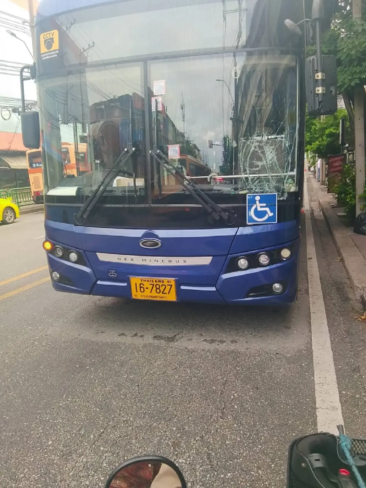 อาการล่าสุด นศ.ถูกรถเมล์พุ่งชนบนทางม้าลาย หวั่นอนาคตการเรียน